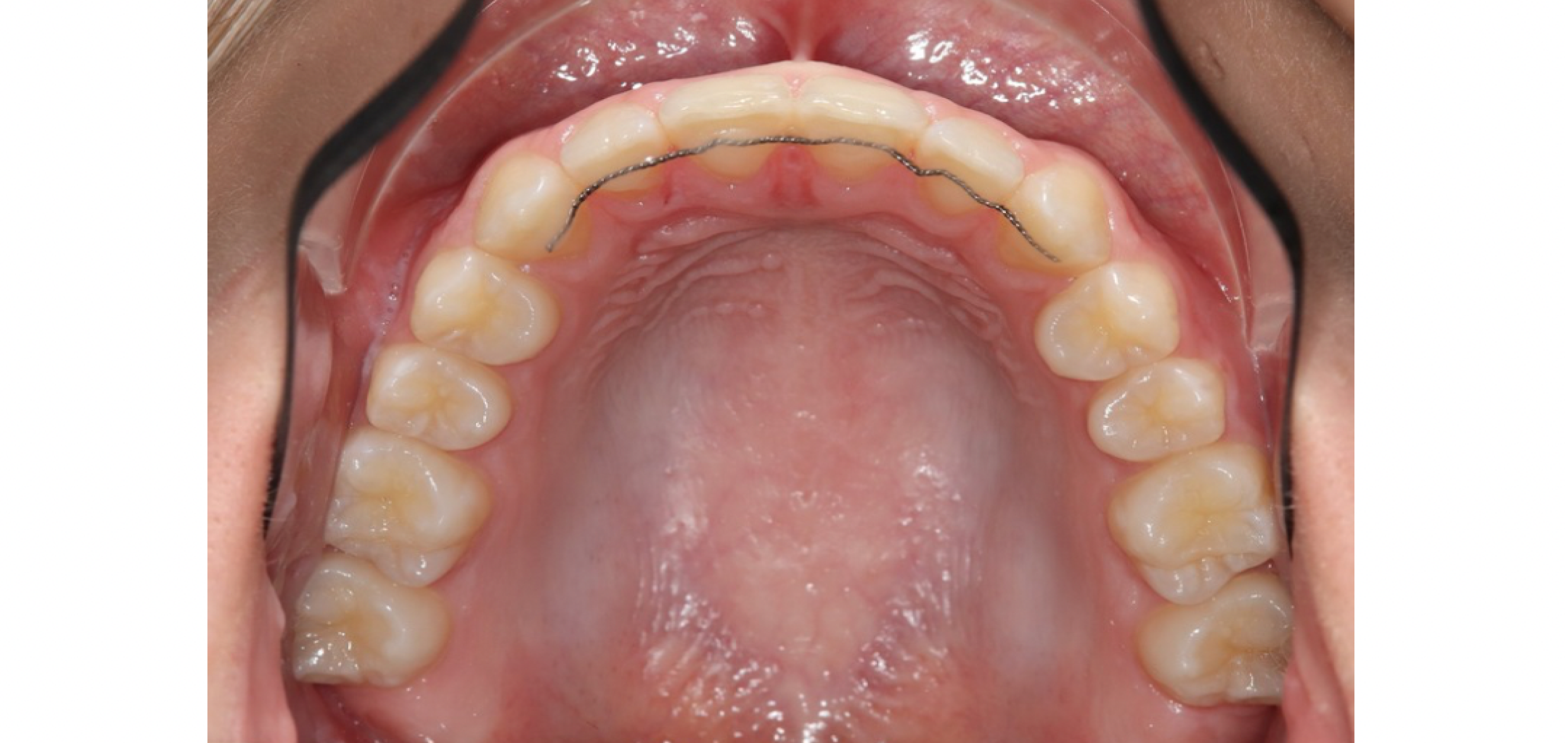 Exemples de cas traités par le Dr Quentin Boison