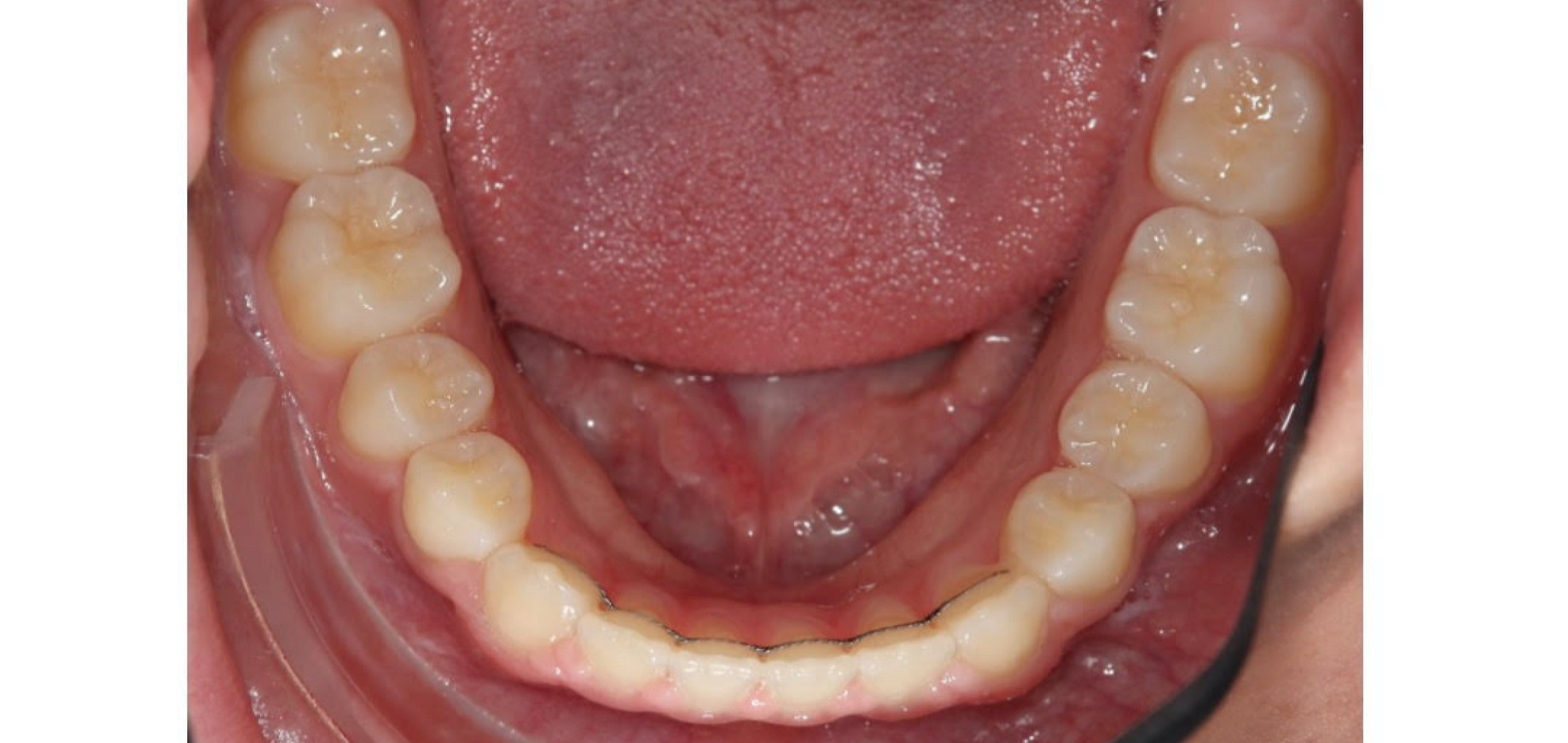 Exemples de cas traités par le Dr Quentin Boison