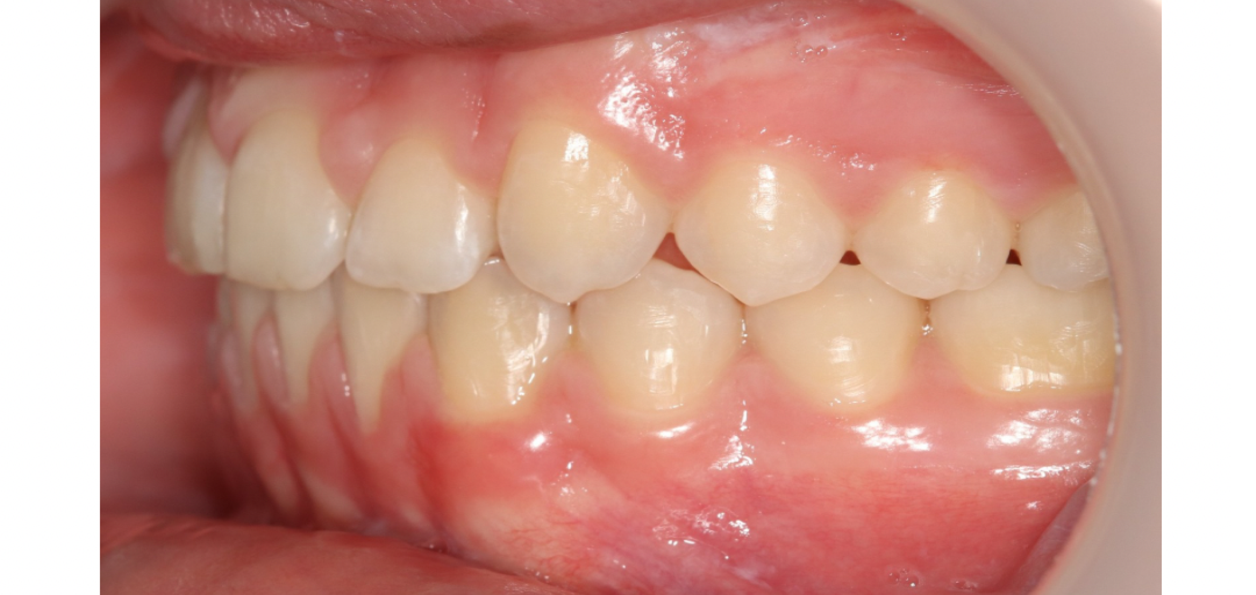 Exemples de cas traités par le Dr Quentin Boison