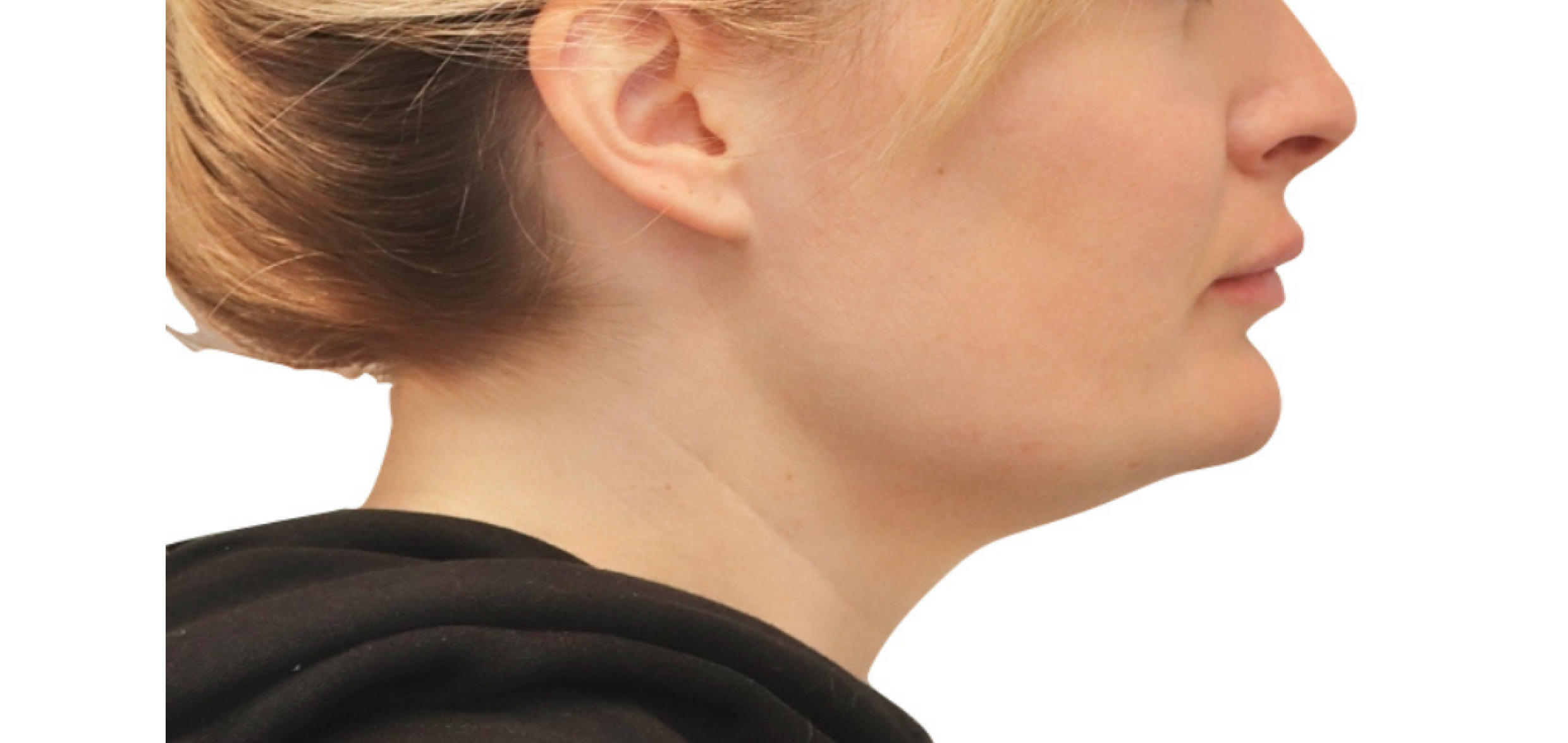 Exemples de cas traités par le Dr Quentin Boison