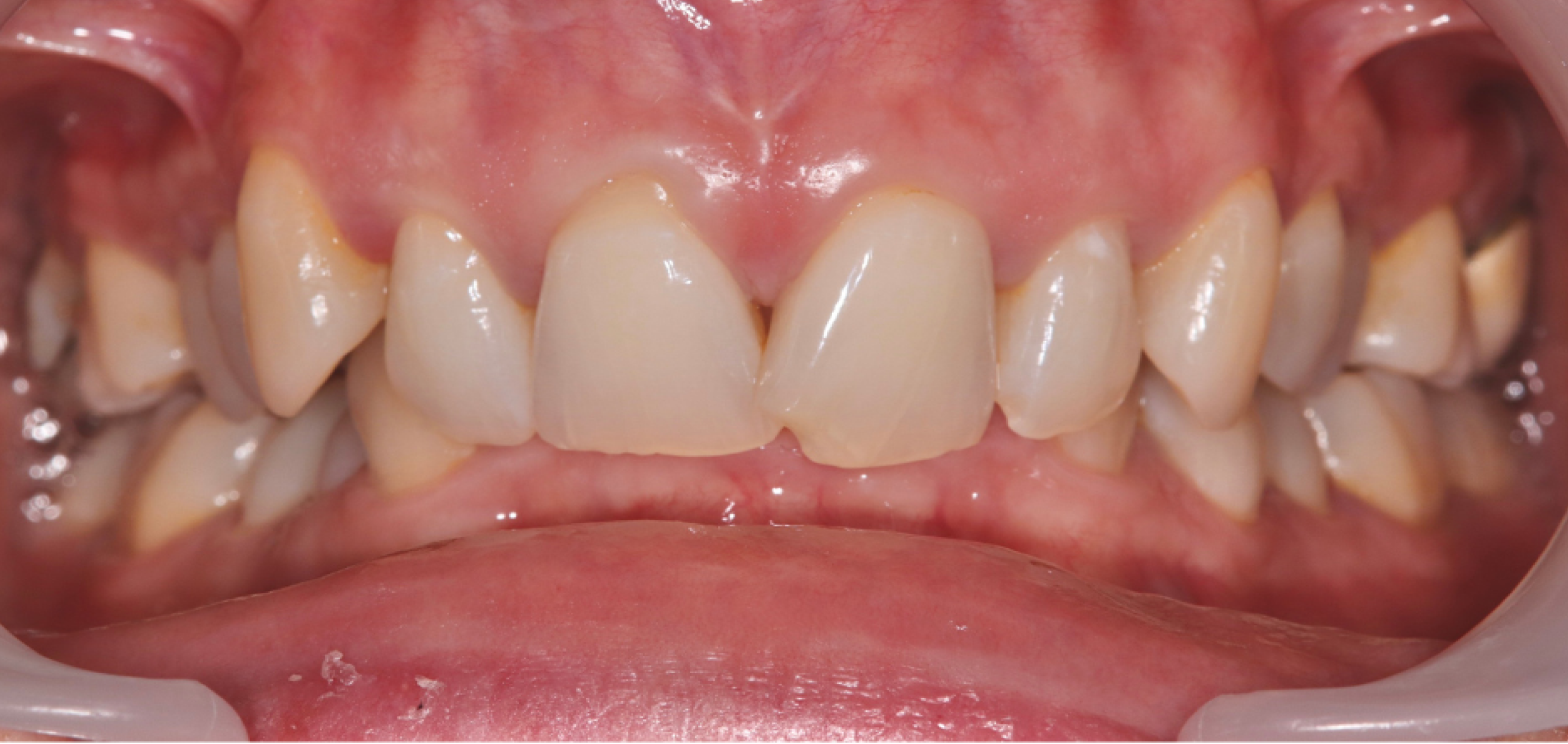 Exemples de cas traités par le Dr Quentin Boison