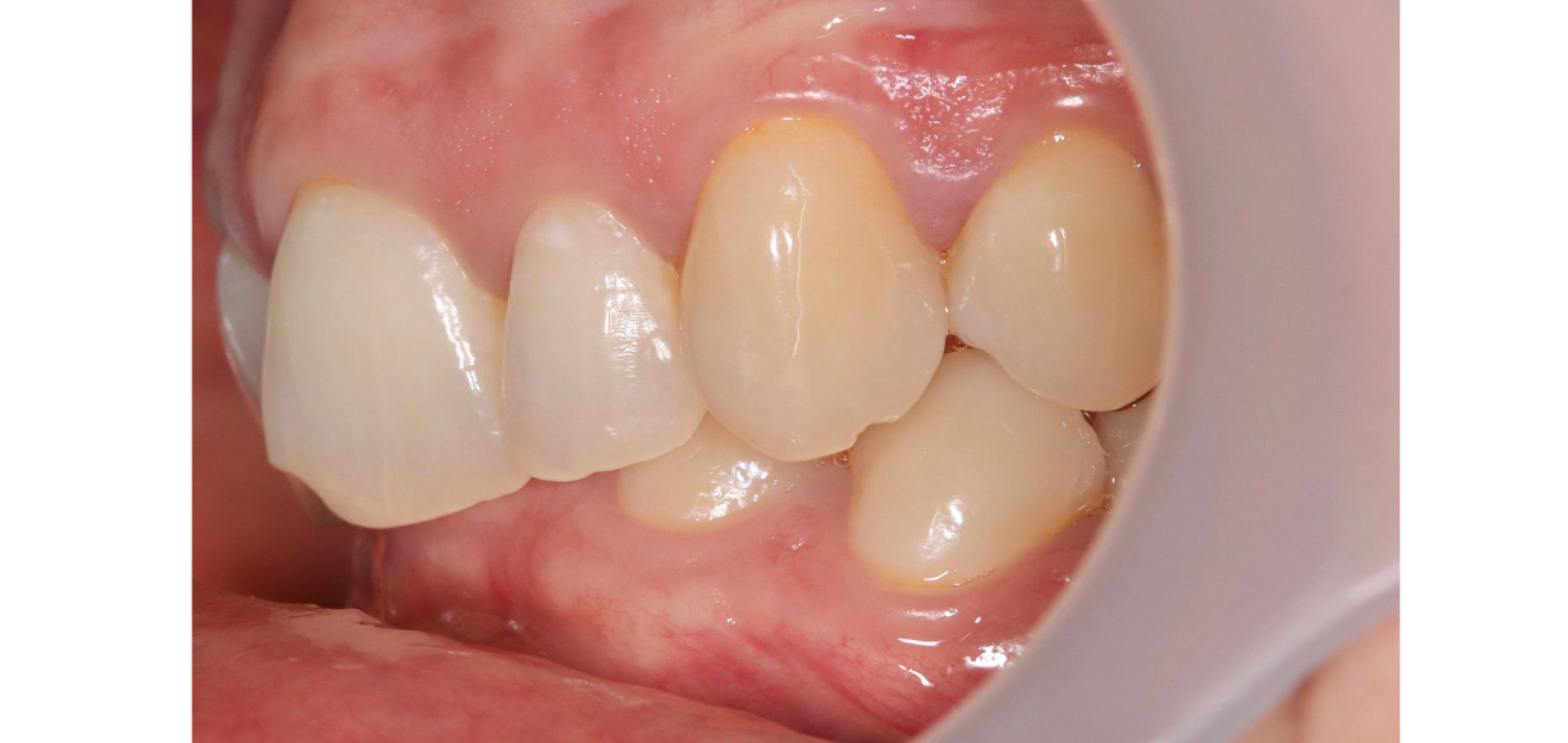 Exemples de cas traités par le Dr Quentin Boison