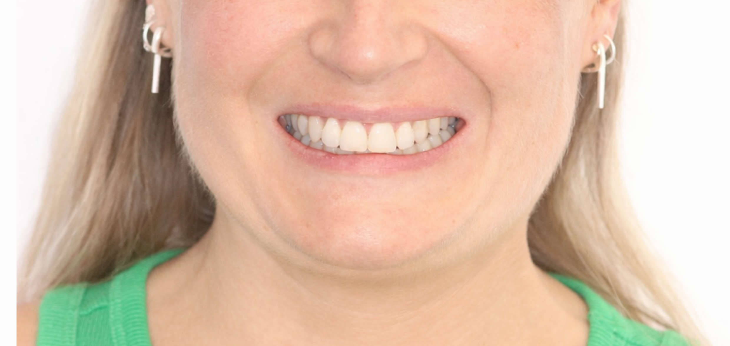 Exemples de cas traités par le Dr Quentin Boison