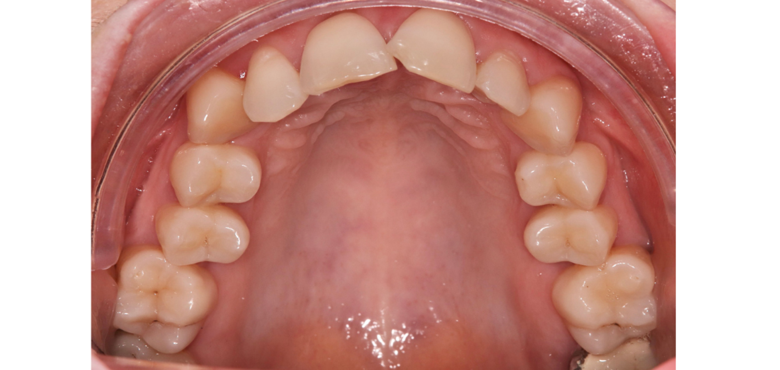 Exemples de cas traités par le Dr Quentin Boison