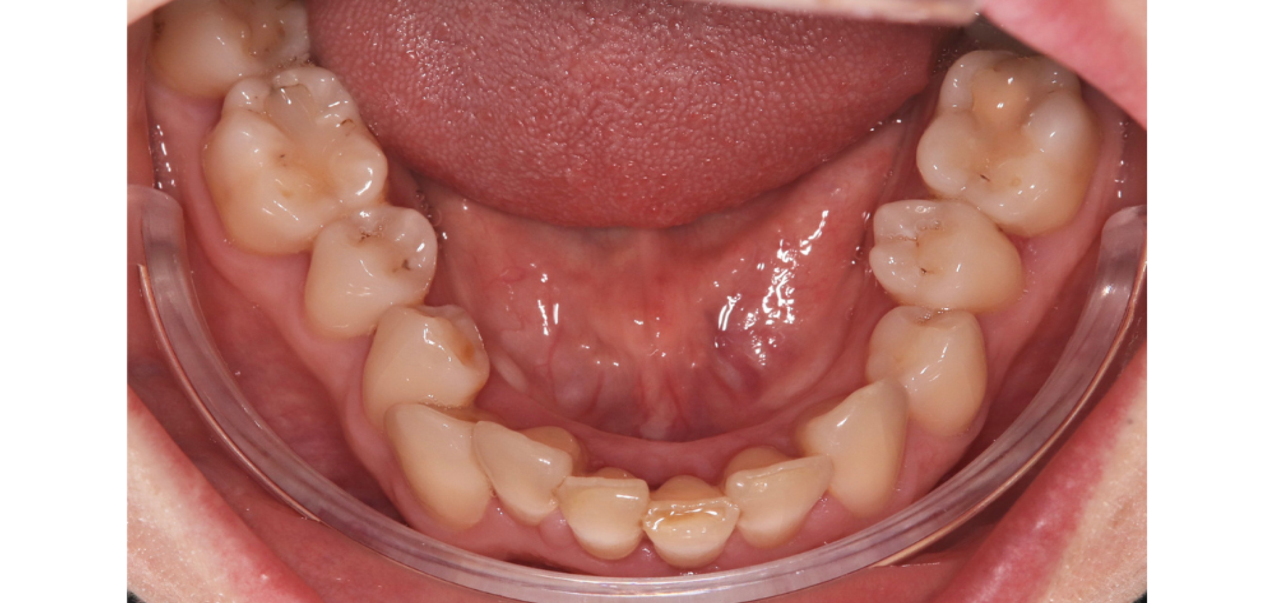 Exemples de cas traités par le Dr Quentin Boison