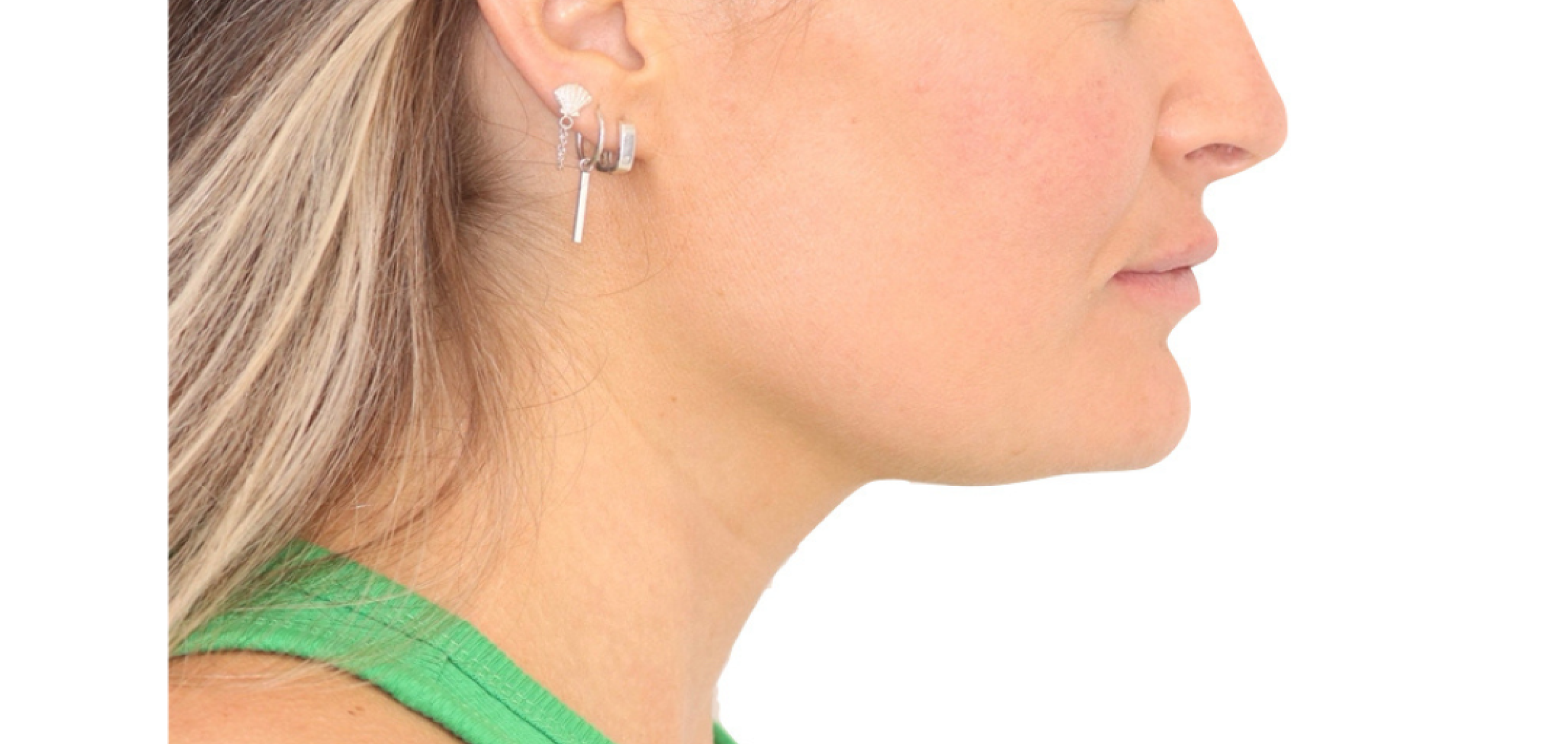 Exemples de cas traités par le Dr Quentin Boison