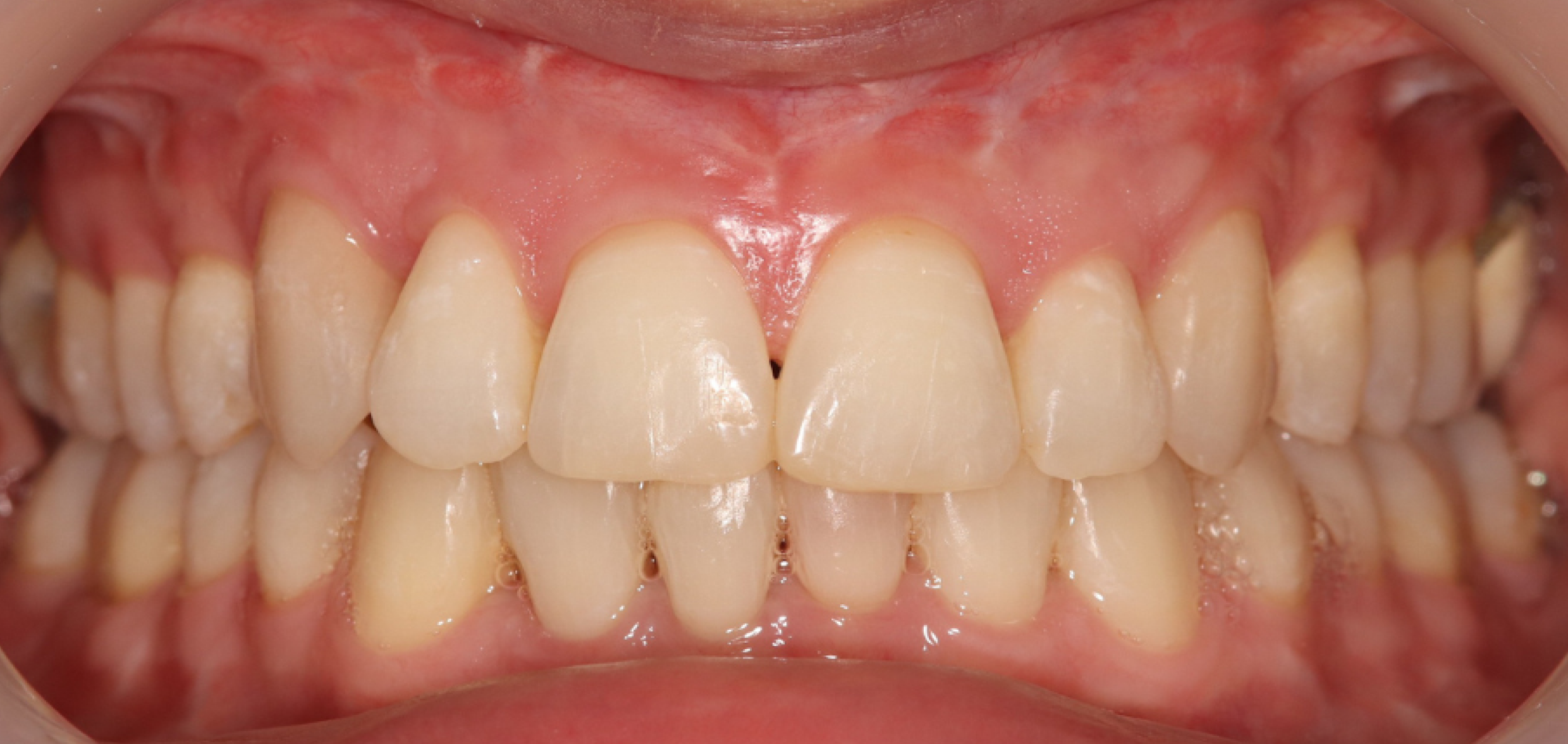 Exemples de cas traités par le Dr Quentin Boison