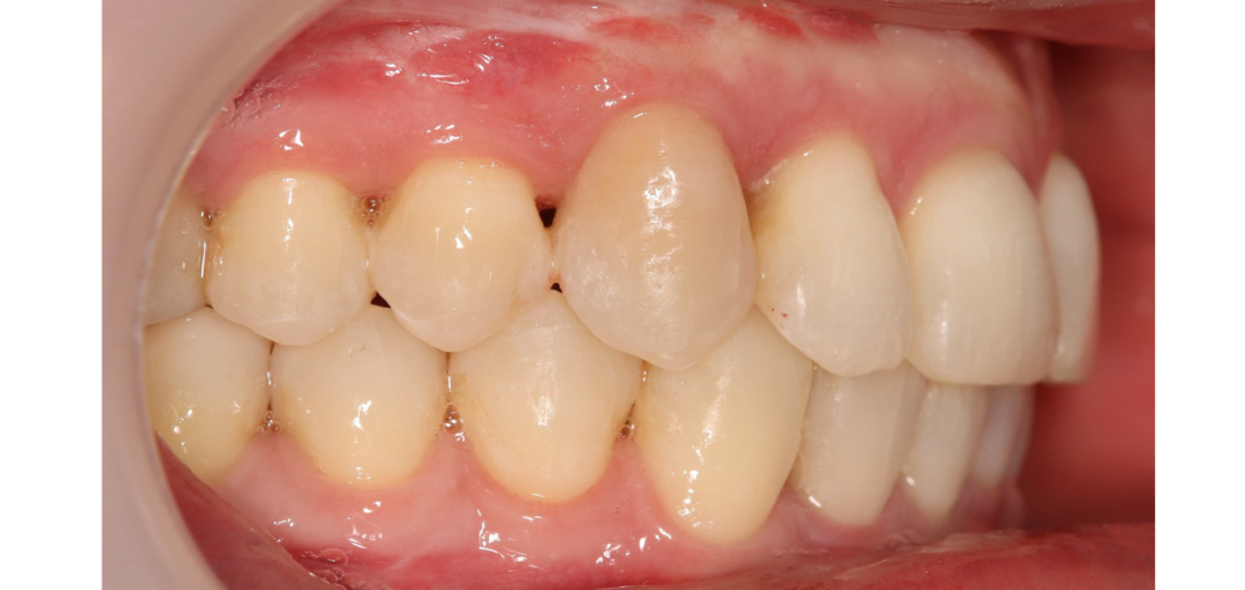 Exemples de cas traités par le Dr Quentin Boison