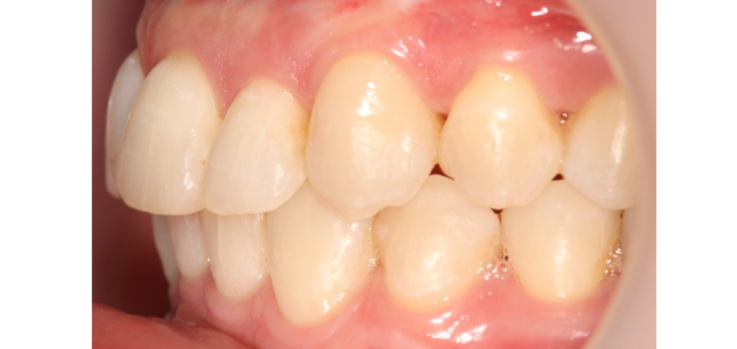 Exemples de cas traités par le Dr Quentin Boison