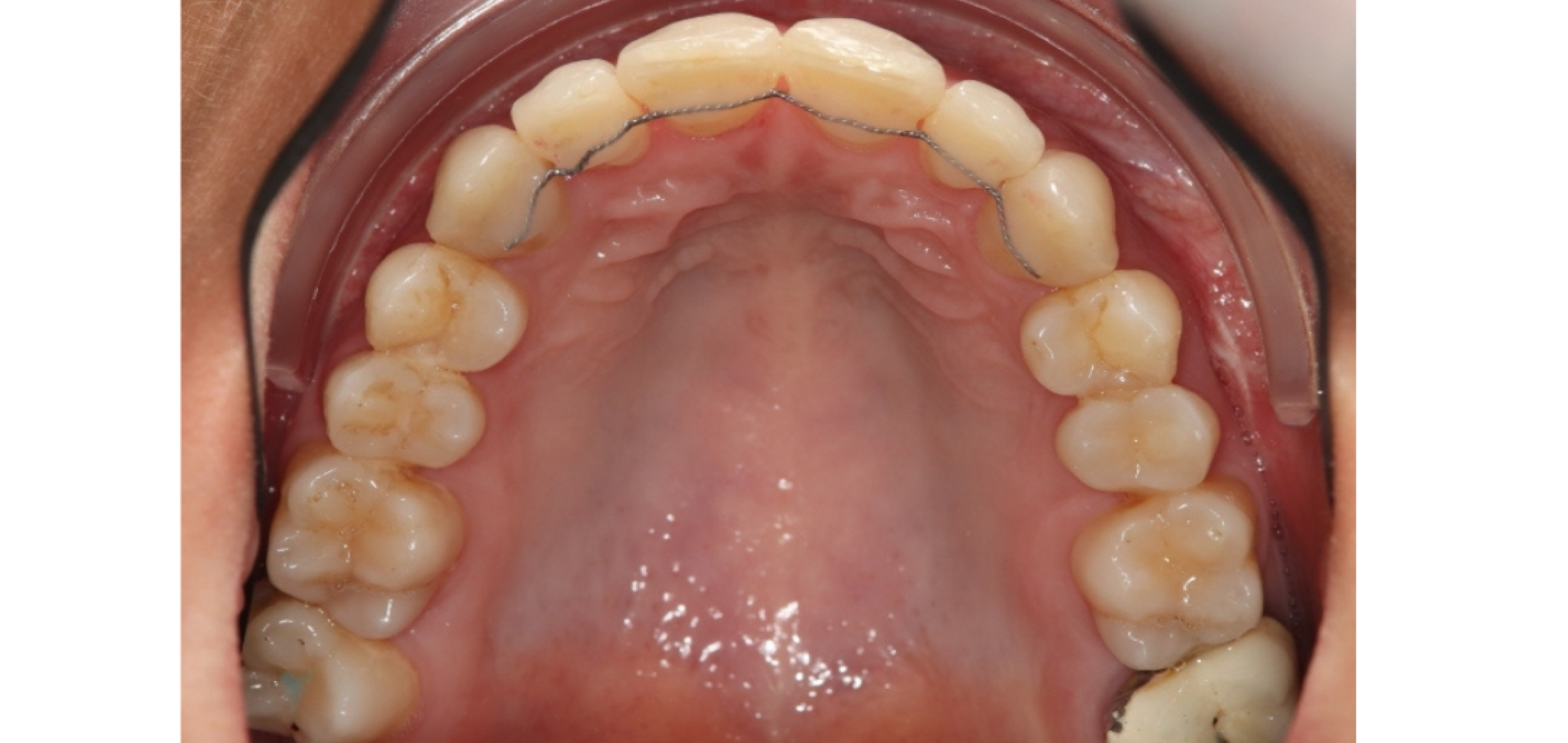 Exemples de cas traités par le Dr Quentin Boison