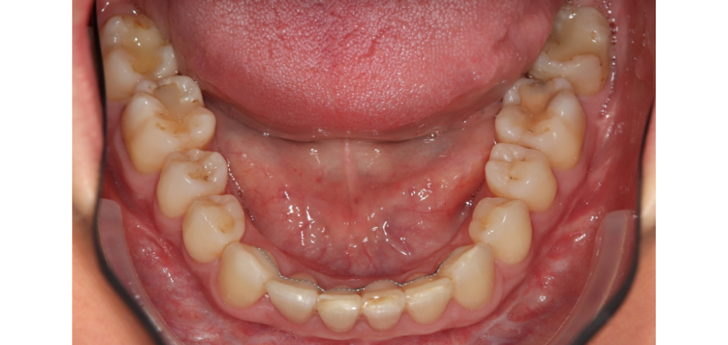 Exemples de cas traités par le Dr Quentin Boison