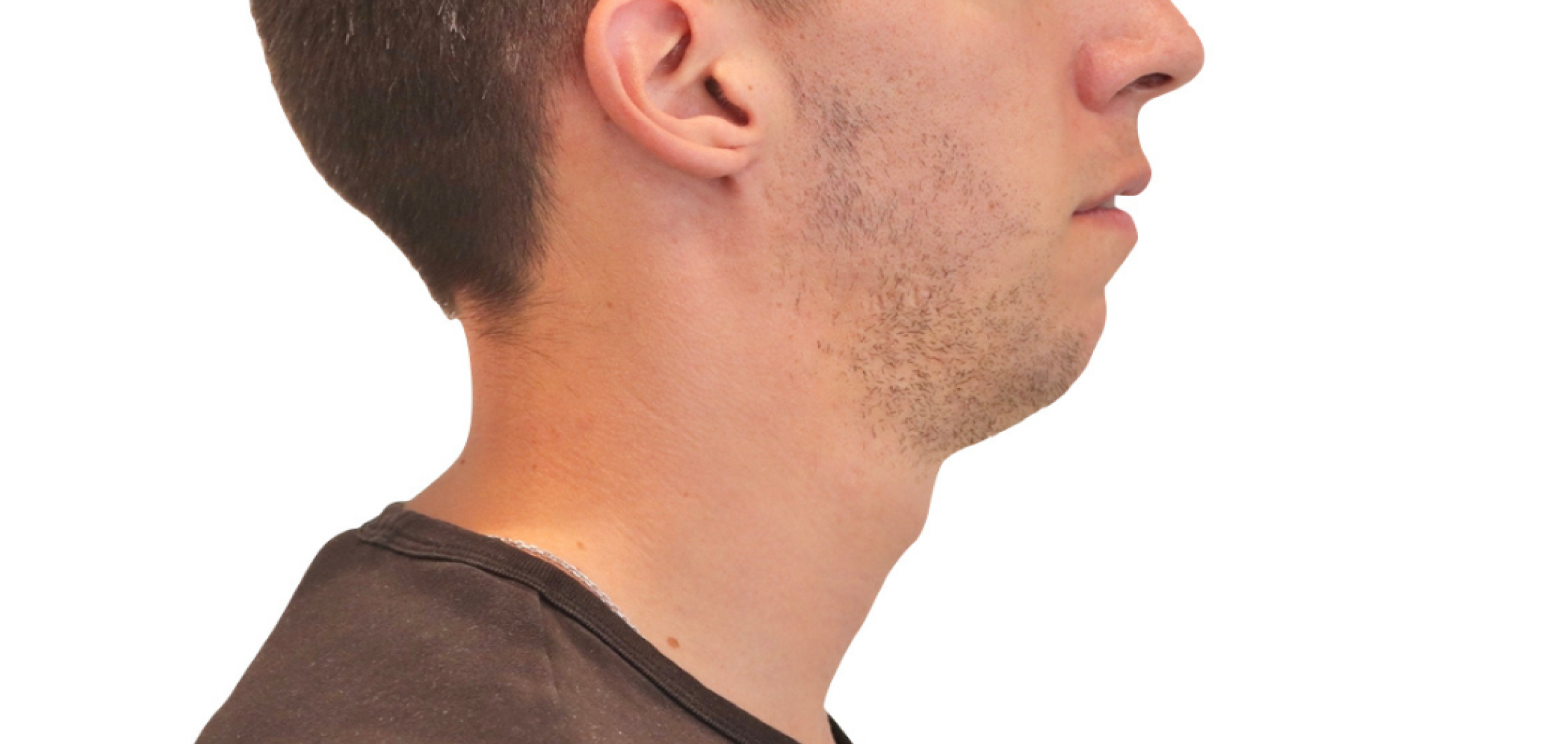 Exemples de cas traités par le Dr Quentin Boison