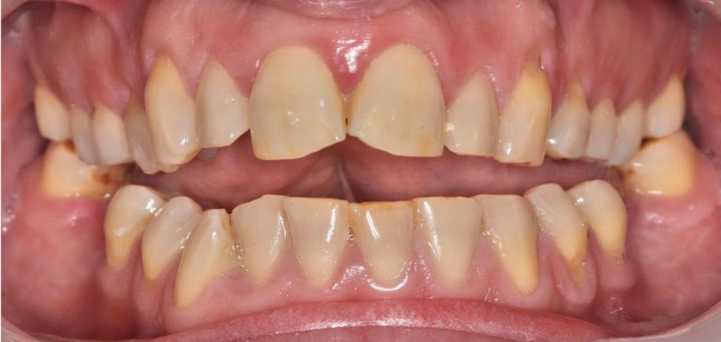 Exemples de cas traités par le Dr Quentin Boison