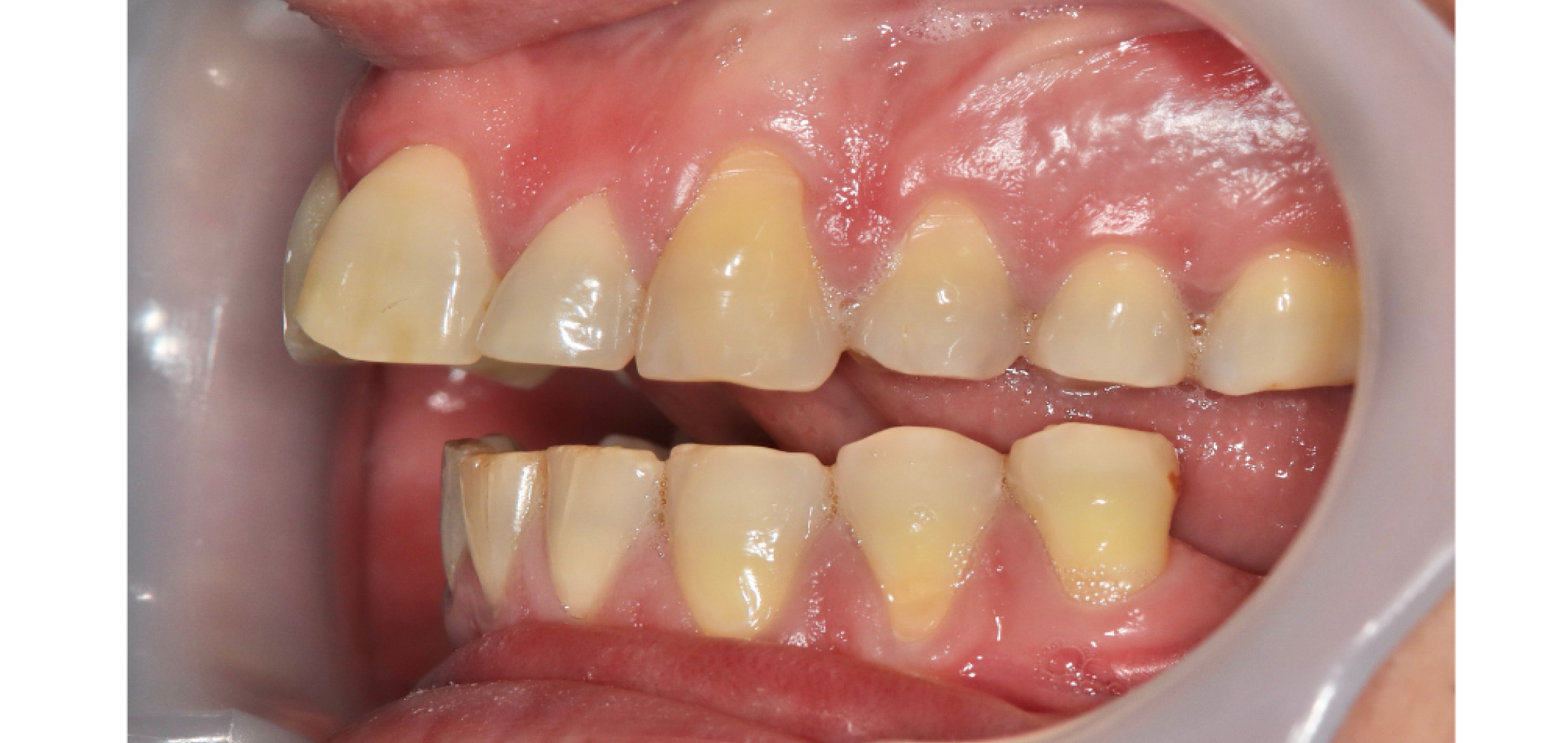 Exemples de cas traités par le Dr Quentin Boison