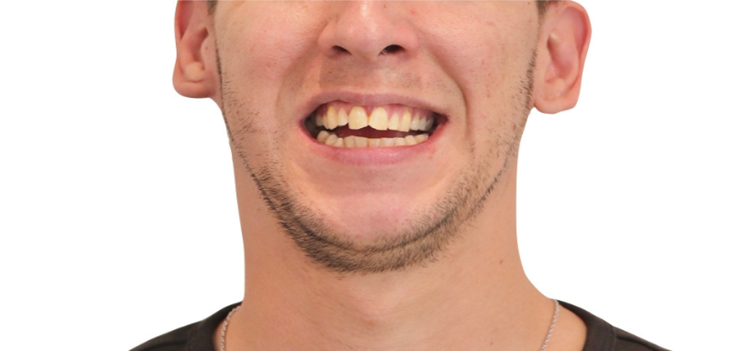 Exemples de cas traités par le Dr Quentin Boison