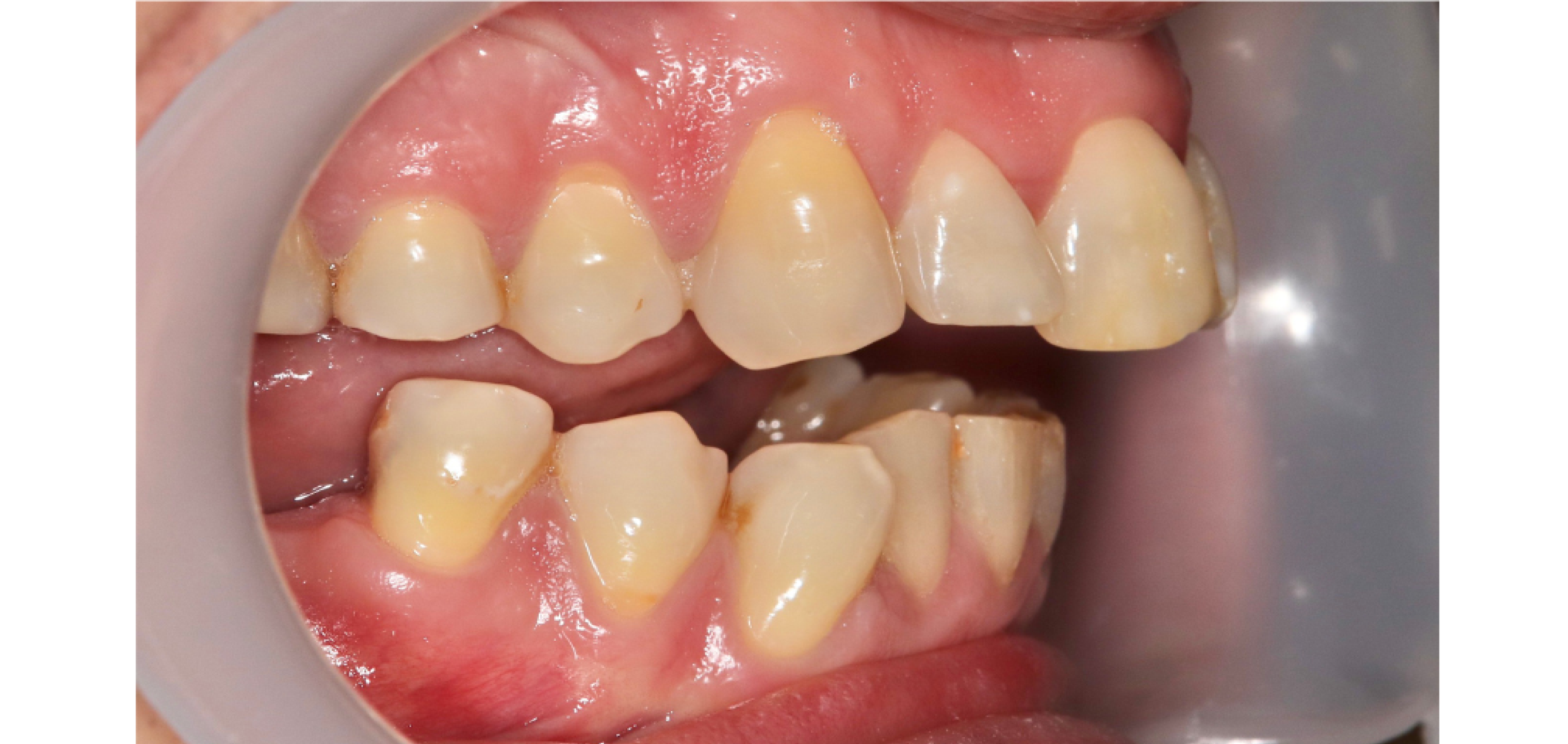 Exemples de cas traités par le Dr Quentin Boison