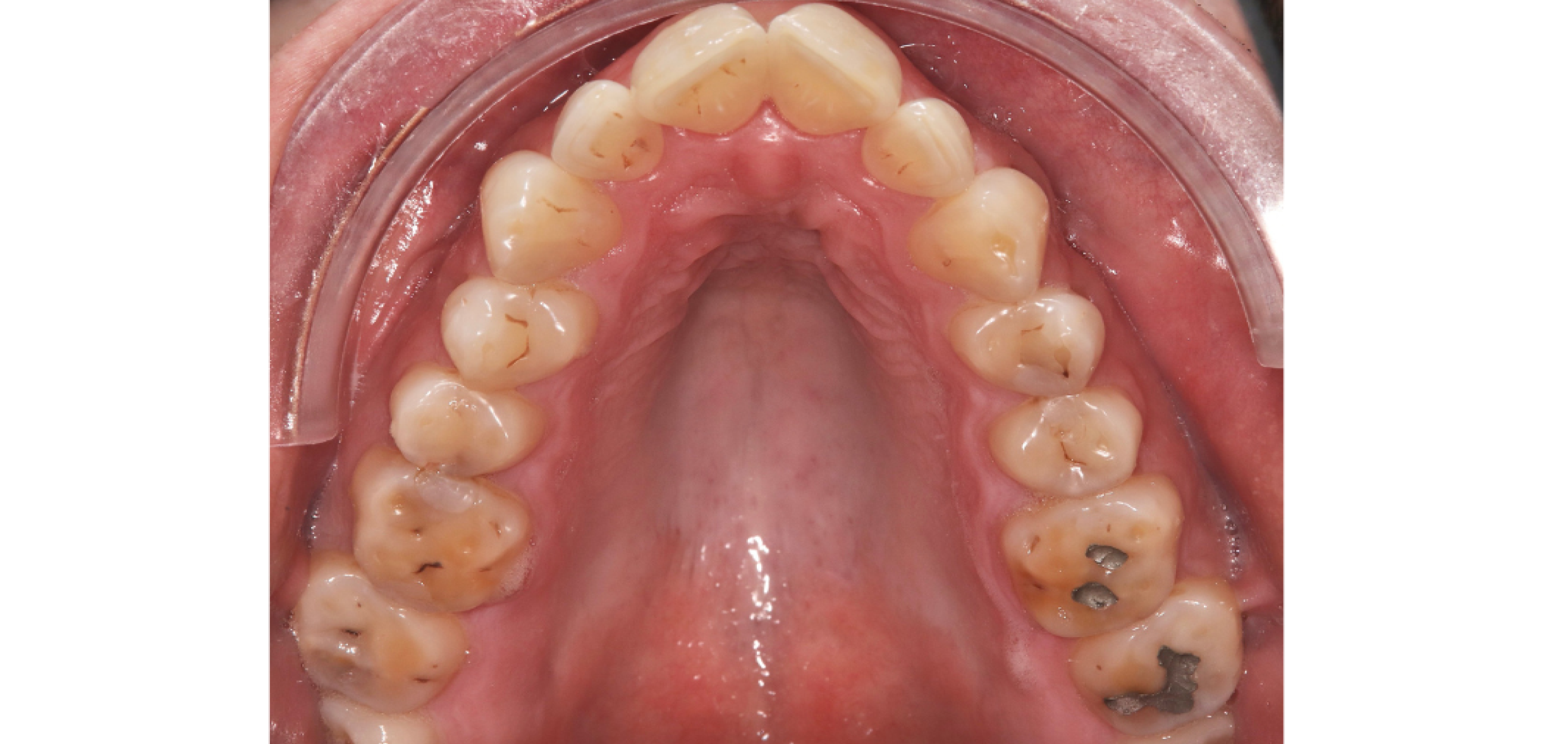 Exemples de cas traités par le Dr Quentin Boison