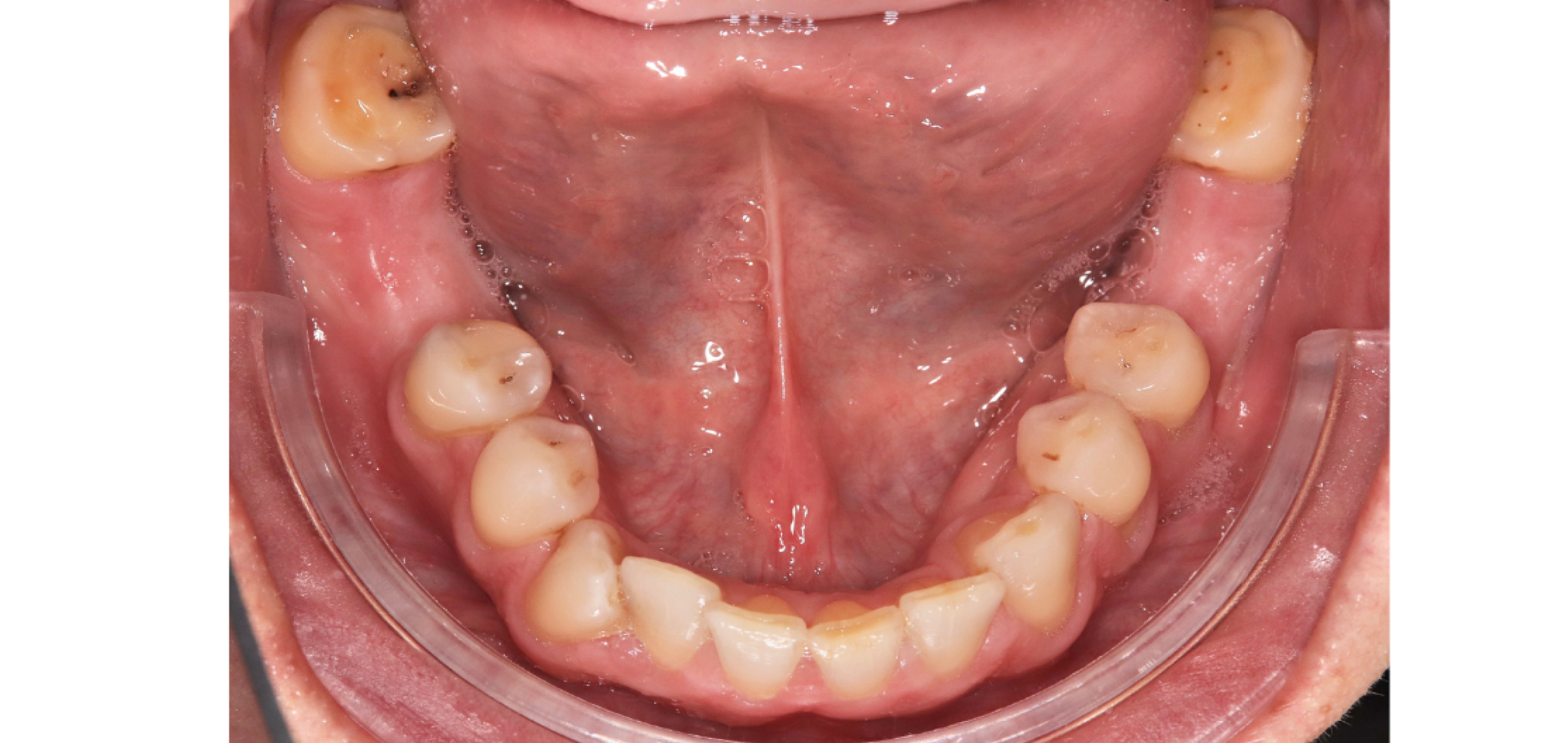 Exemples de cas traités par le Dr Quentin Boison
