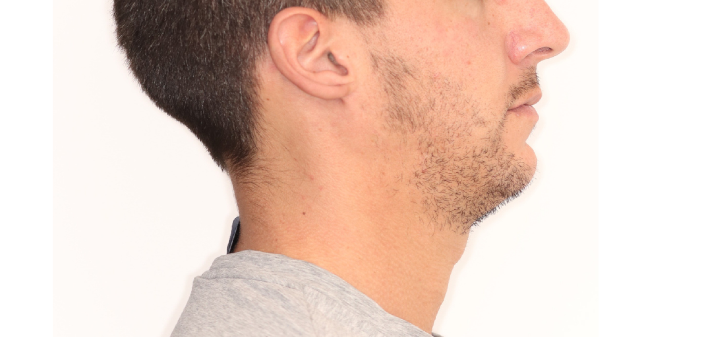 Exemples de cas traités par le Dr Quentin Boison