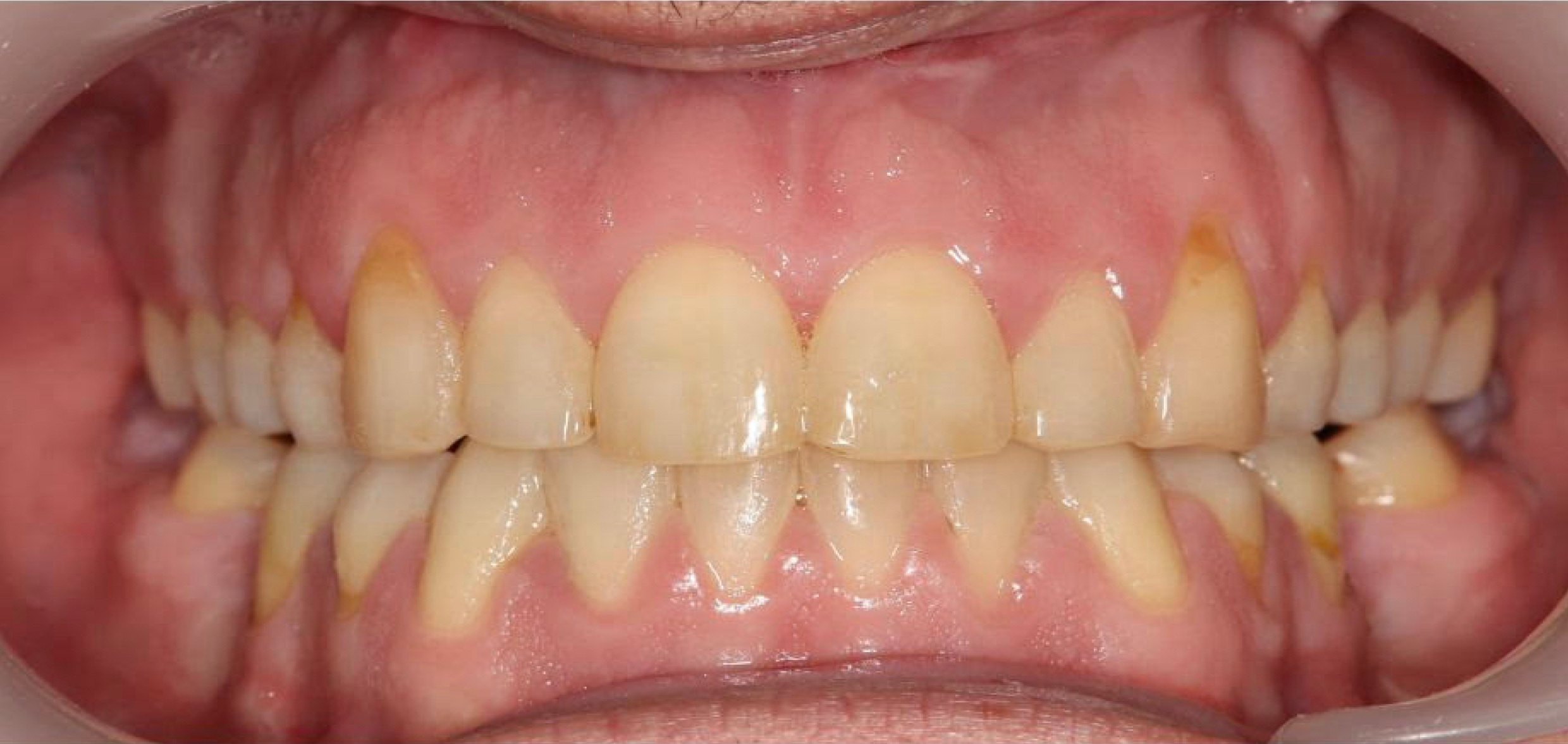 Exemples de cas traités par le Dr Quentin Boison