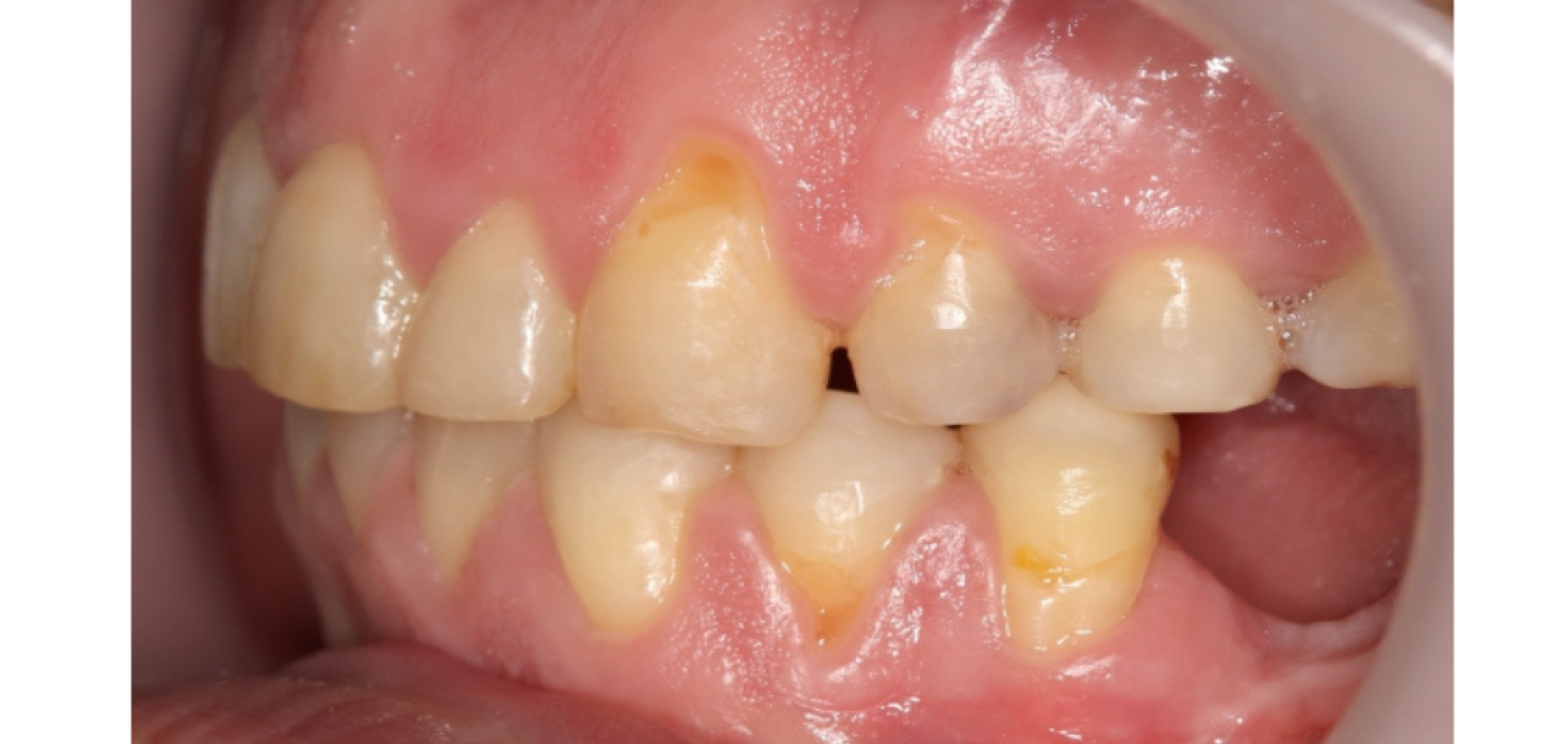 Exemples de cas traités par le Dr Quentin Boison