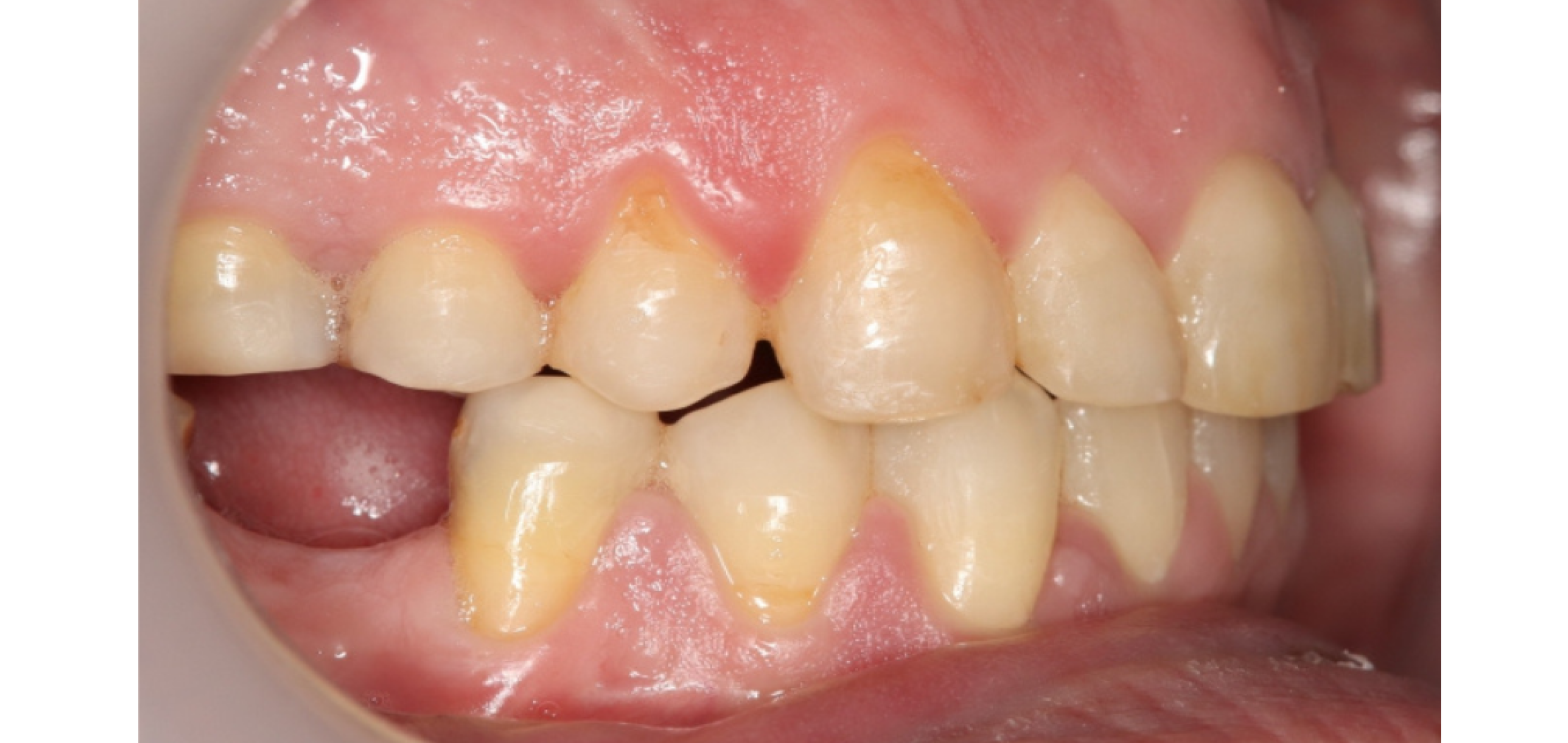 Exemples de cas traités par le Dr Quentin Boison