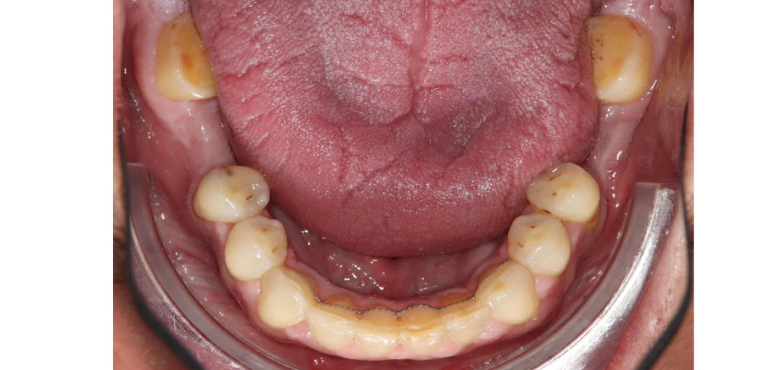 Exemples de cas traités par le Dr Quentin Boison