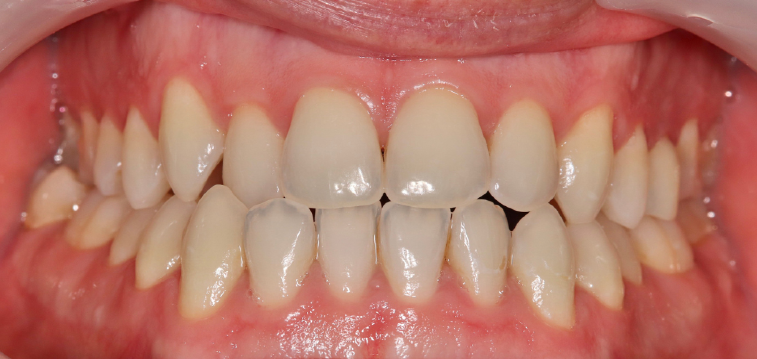 Exemples de cas traités par le Dr Quentin Boison