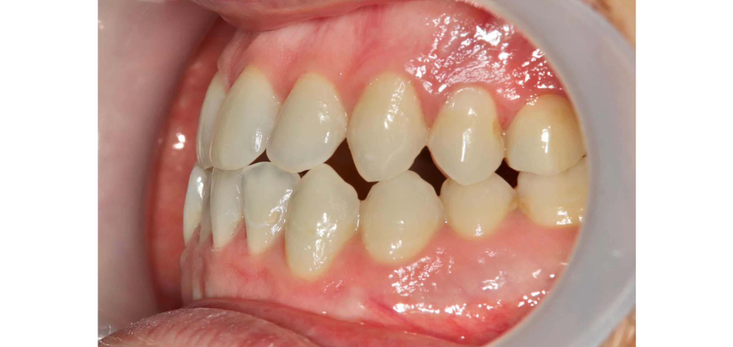 Exemples de cas traités par le Dr Quentin Boison