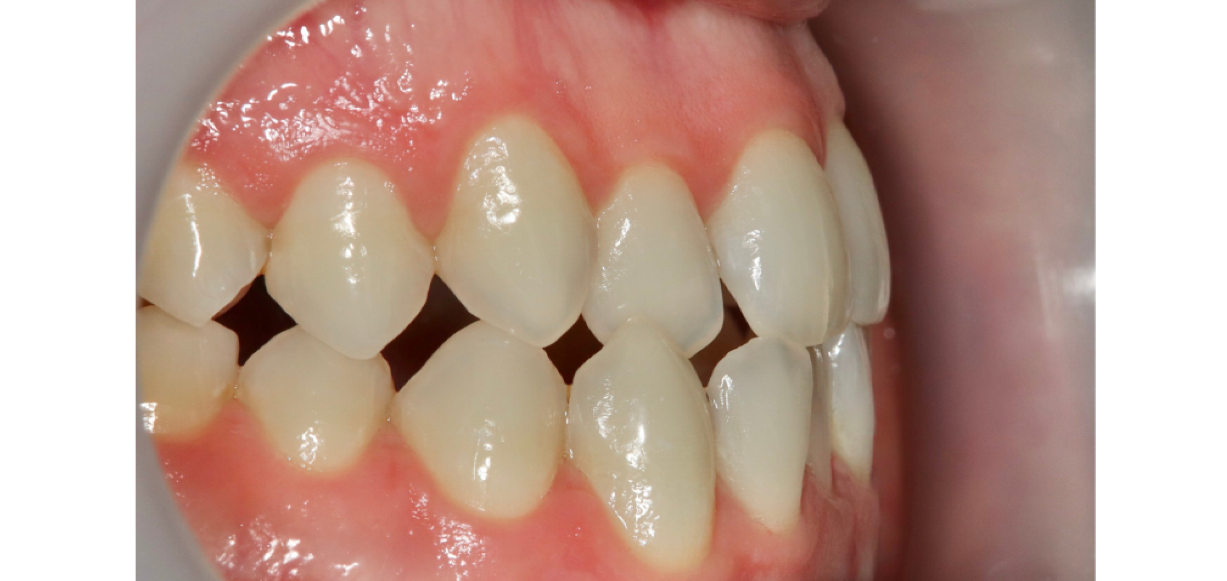 Exemples de cas traités par le Dr Quentin Boison