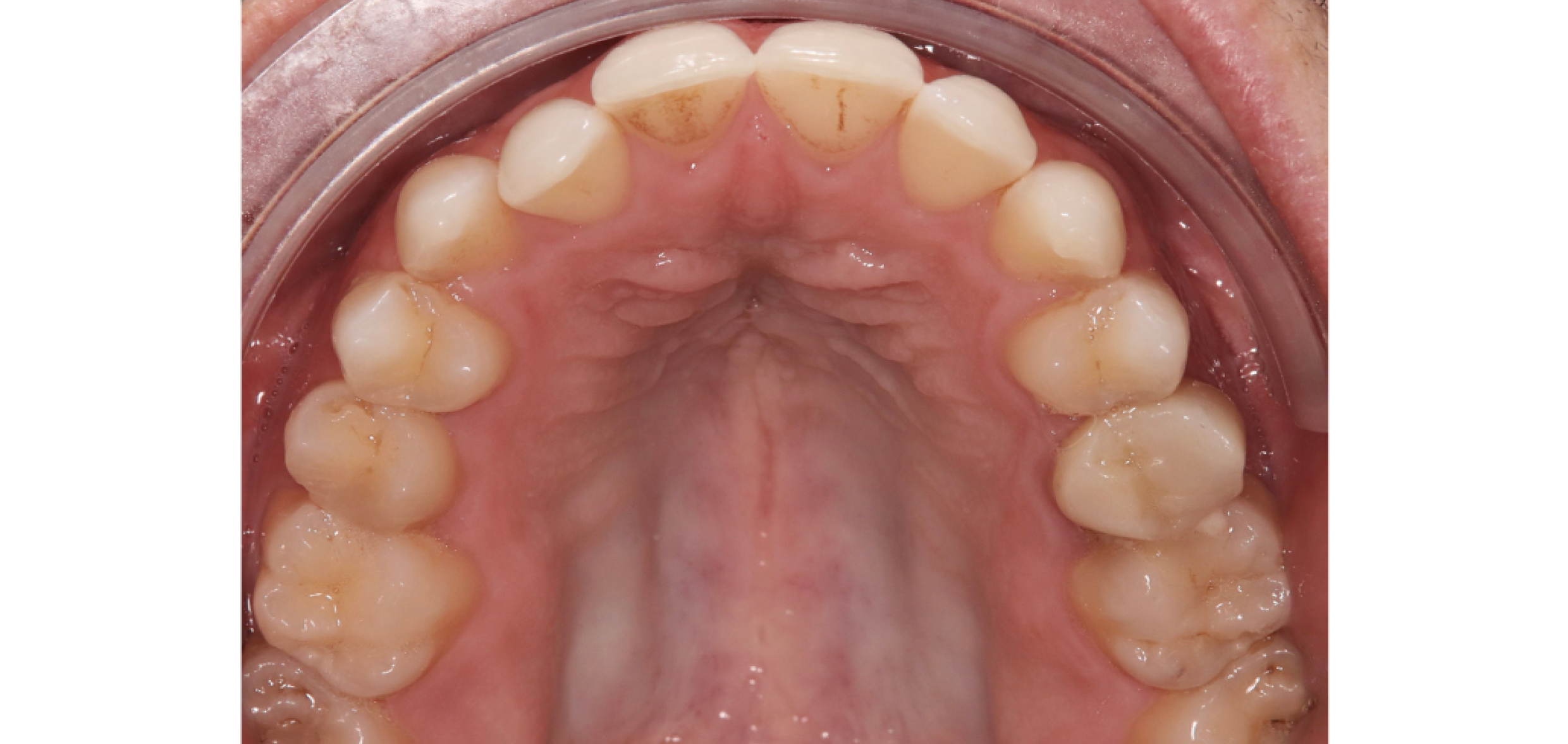 Exemples de cas traités par le Dr Quentin Boison