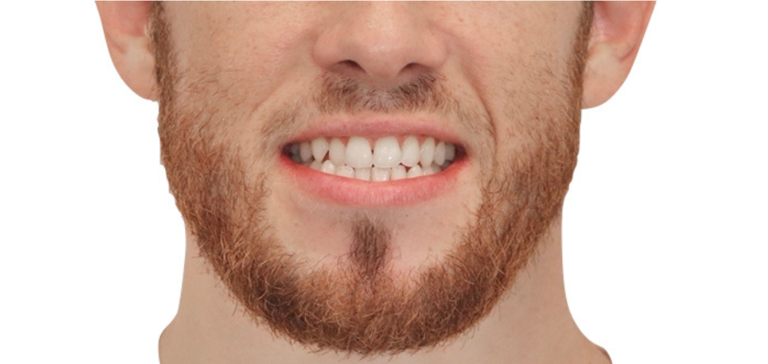 Exemples de cas traités par le Dr Quentin Boison