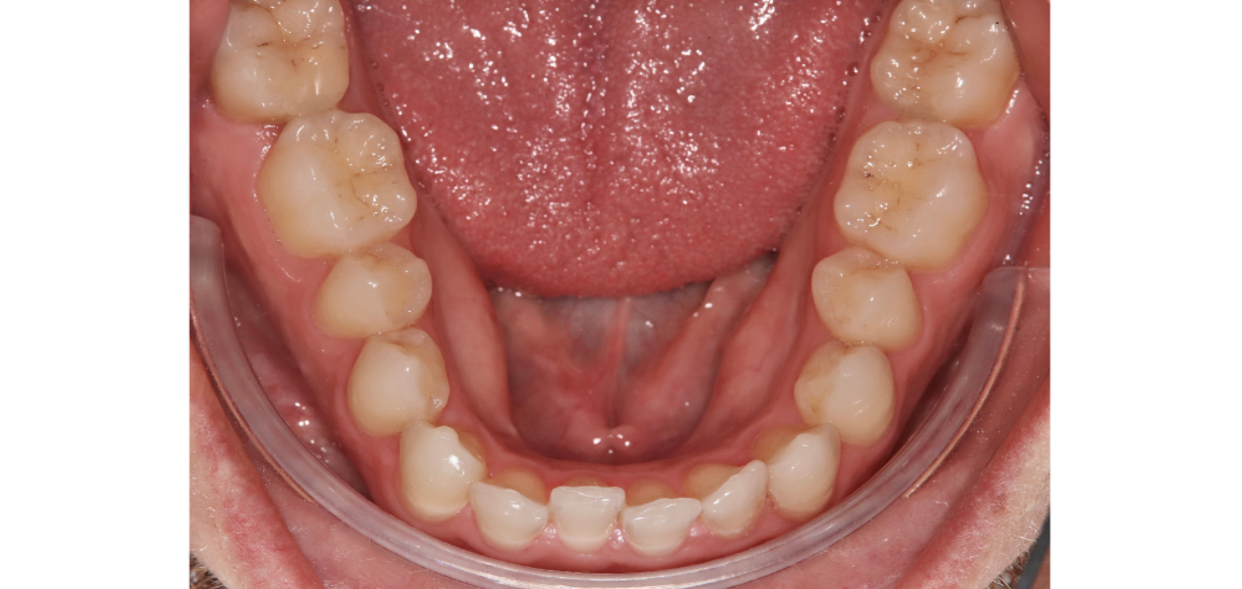 Exemples de cas traités par le Dr Quentin Boison