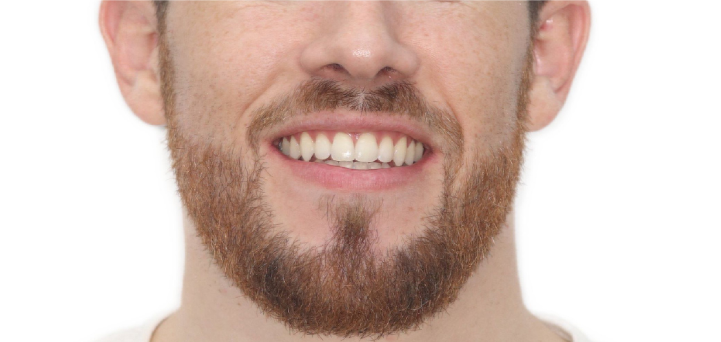 Exemples de cas traités par le Dr Quentin Boison