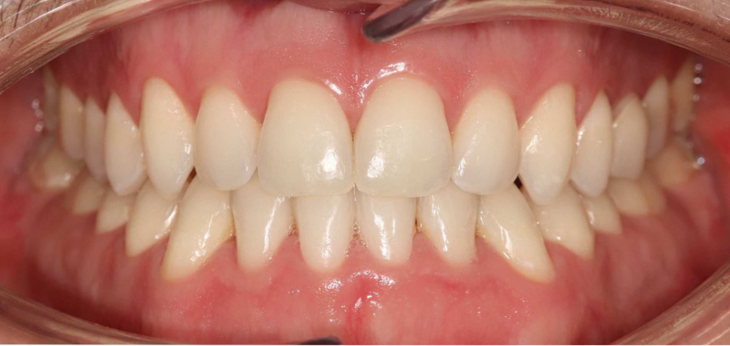 Exemples de cas traités par le Dr Quentin Boison