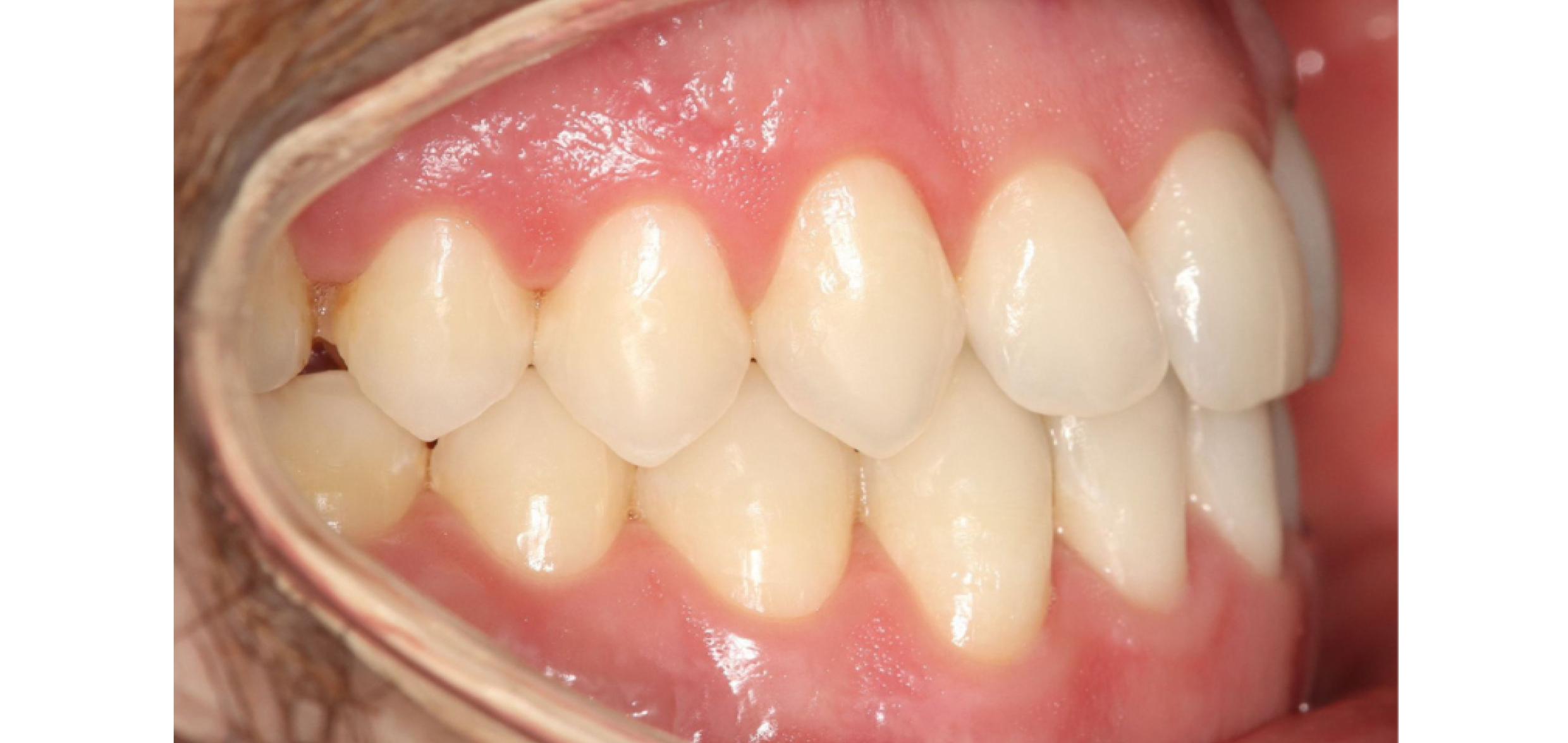 Exemples de cas traités par le Dr Quentin Boison