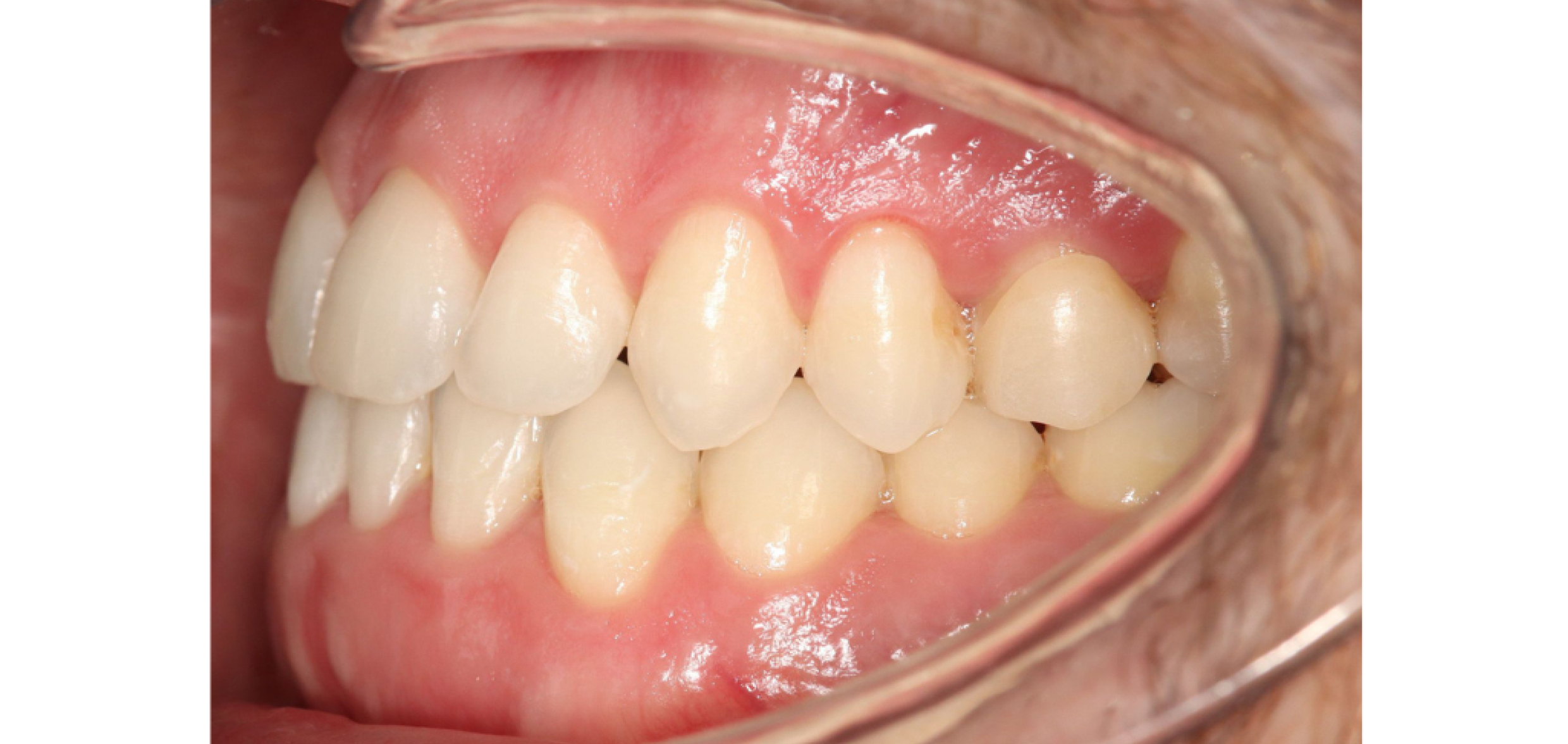 Exemples de cas traités par le Dr Quentin Boison