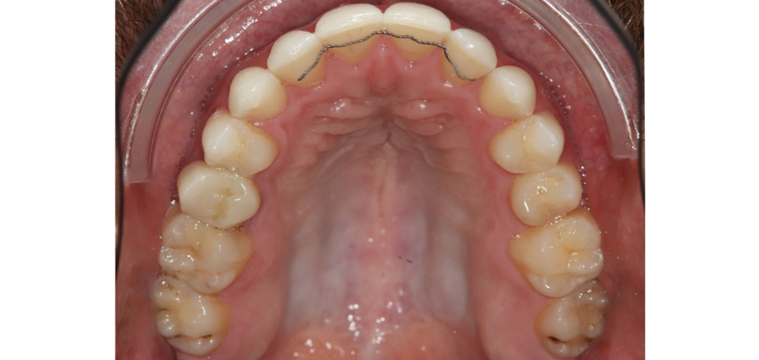 Exemples de cas traités par le Dr Quentin Boison