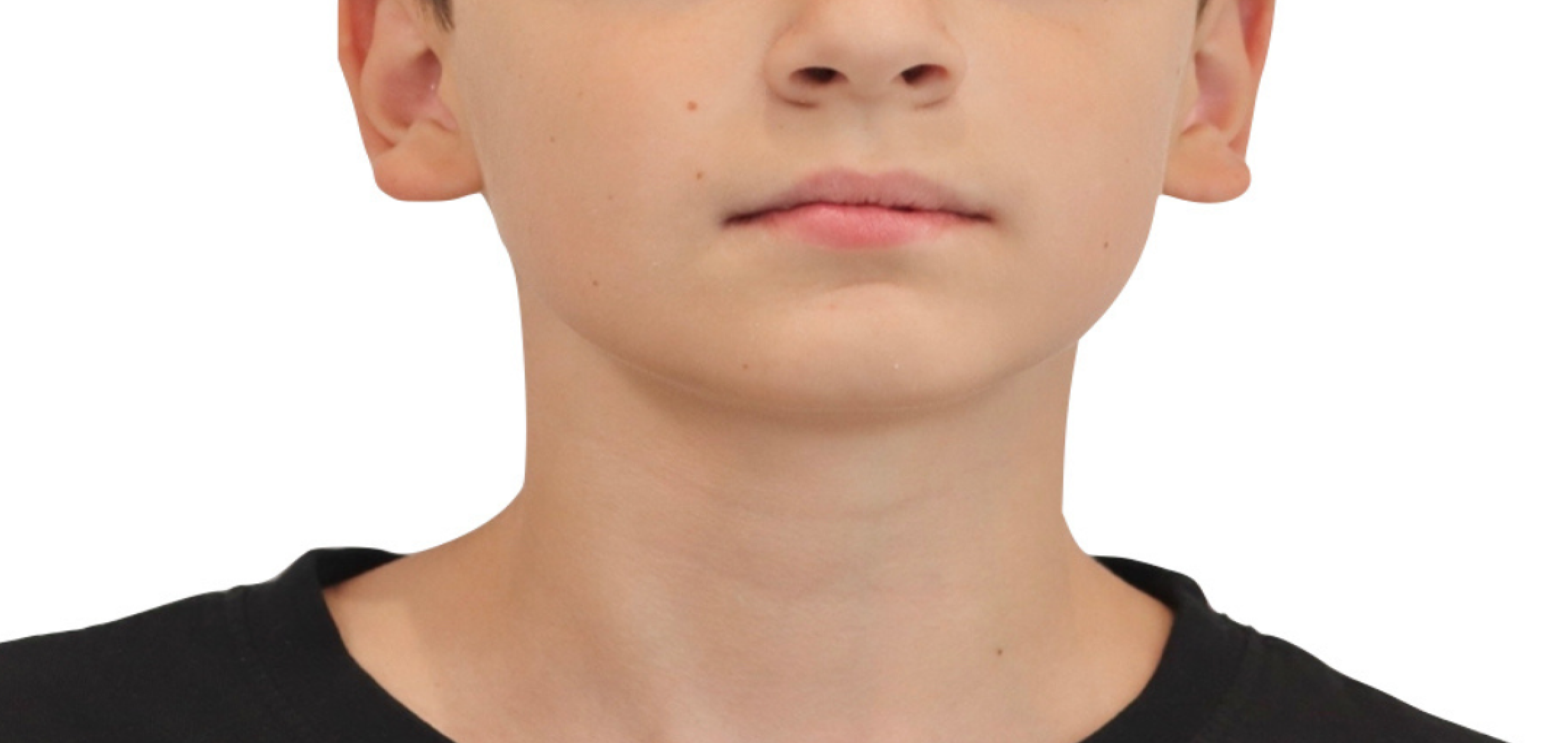 Exemples de cas traités par le Dr Quentin Boison