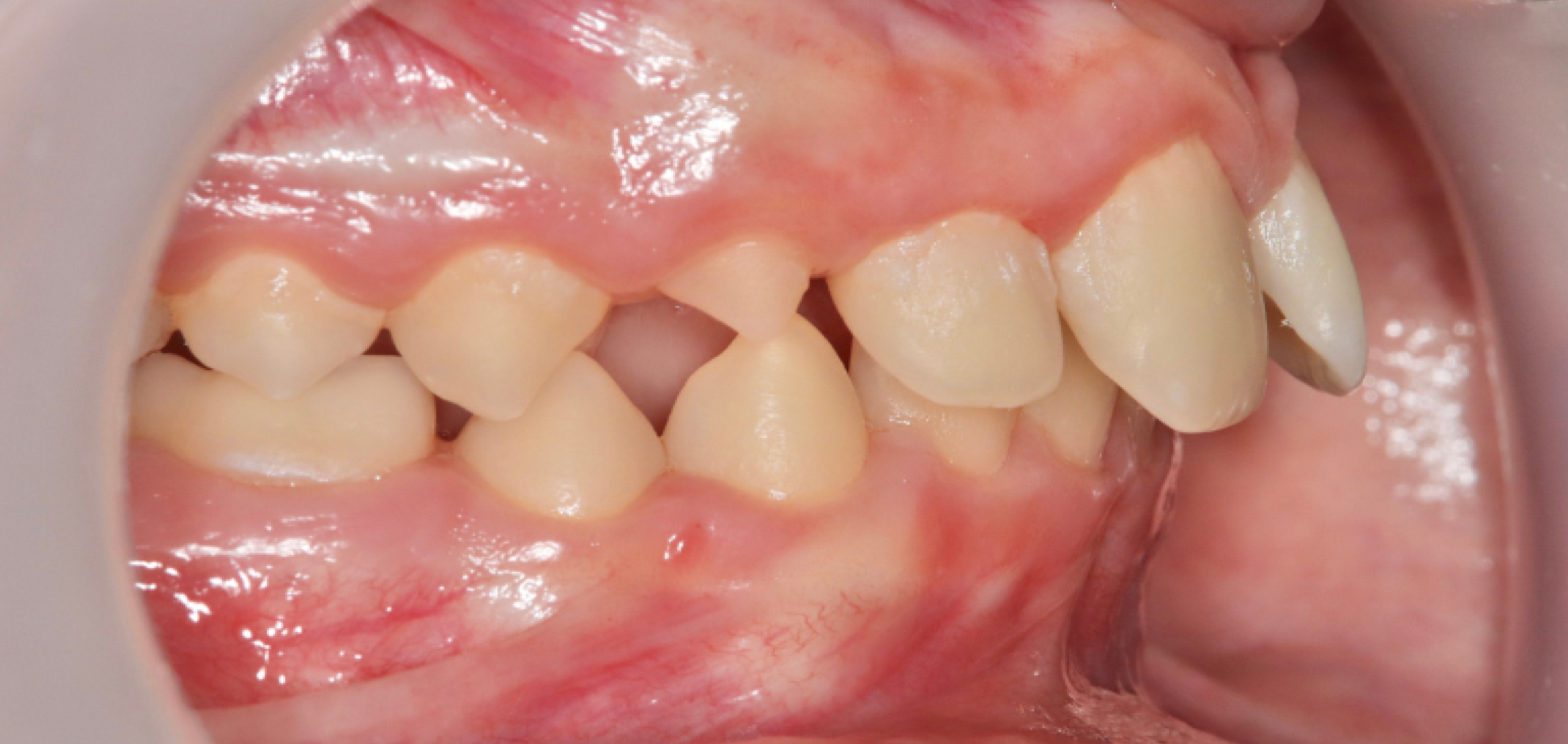 Exemples de cas traités par le Dr Quentin Boison