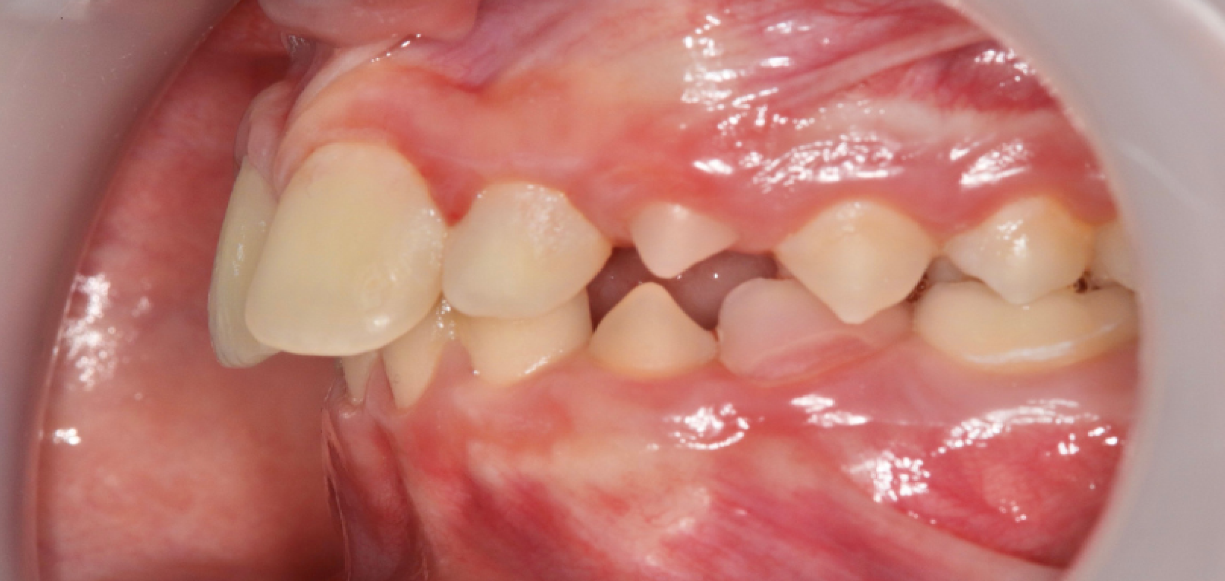 Exemples de cas traités par le Dr Quentin Boison