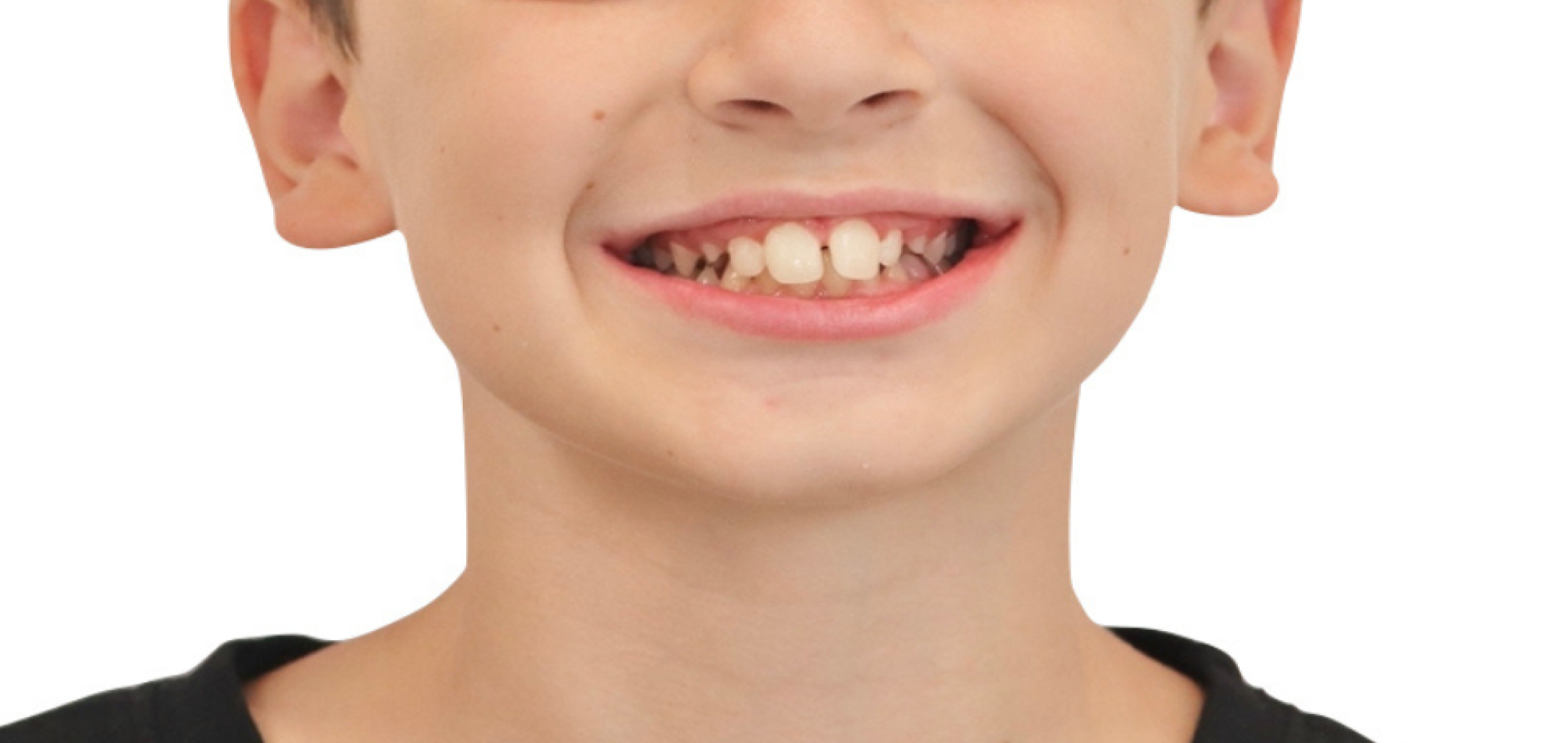 Exemples de cas traités par le Dr Quentin Boison