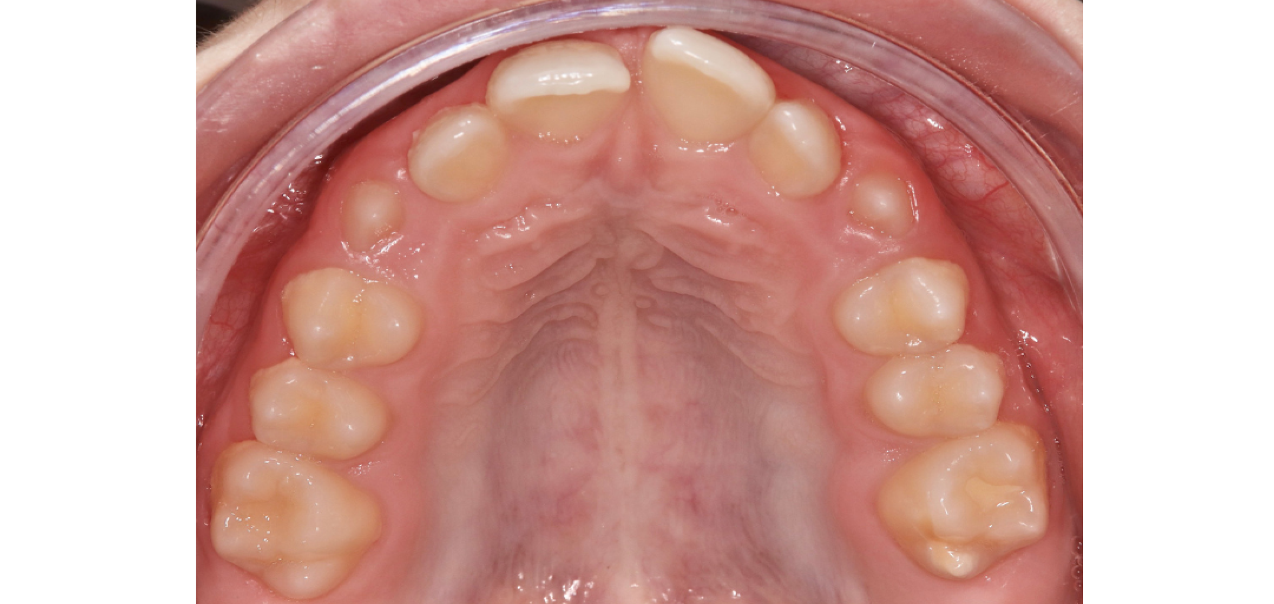 Exemples de cas traités par le Dr Quentin Boison