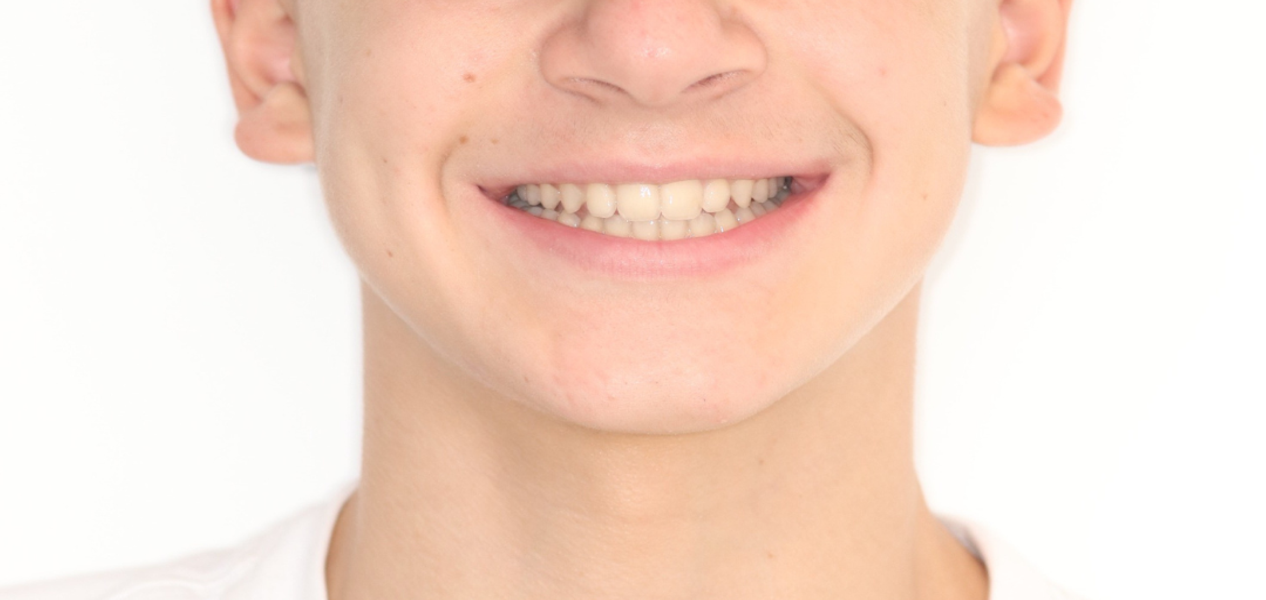 Exemples de cas traités par le Dr Quentin Boison