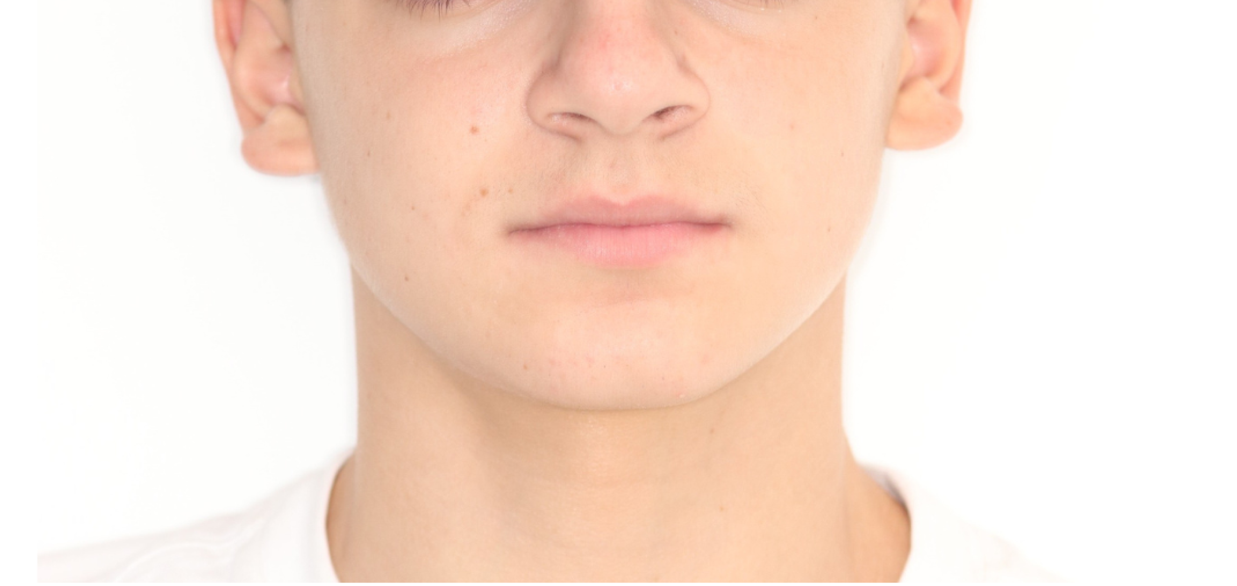 Exemples de cas traités par le Dr Quentin Boison