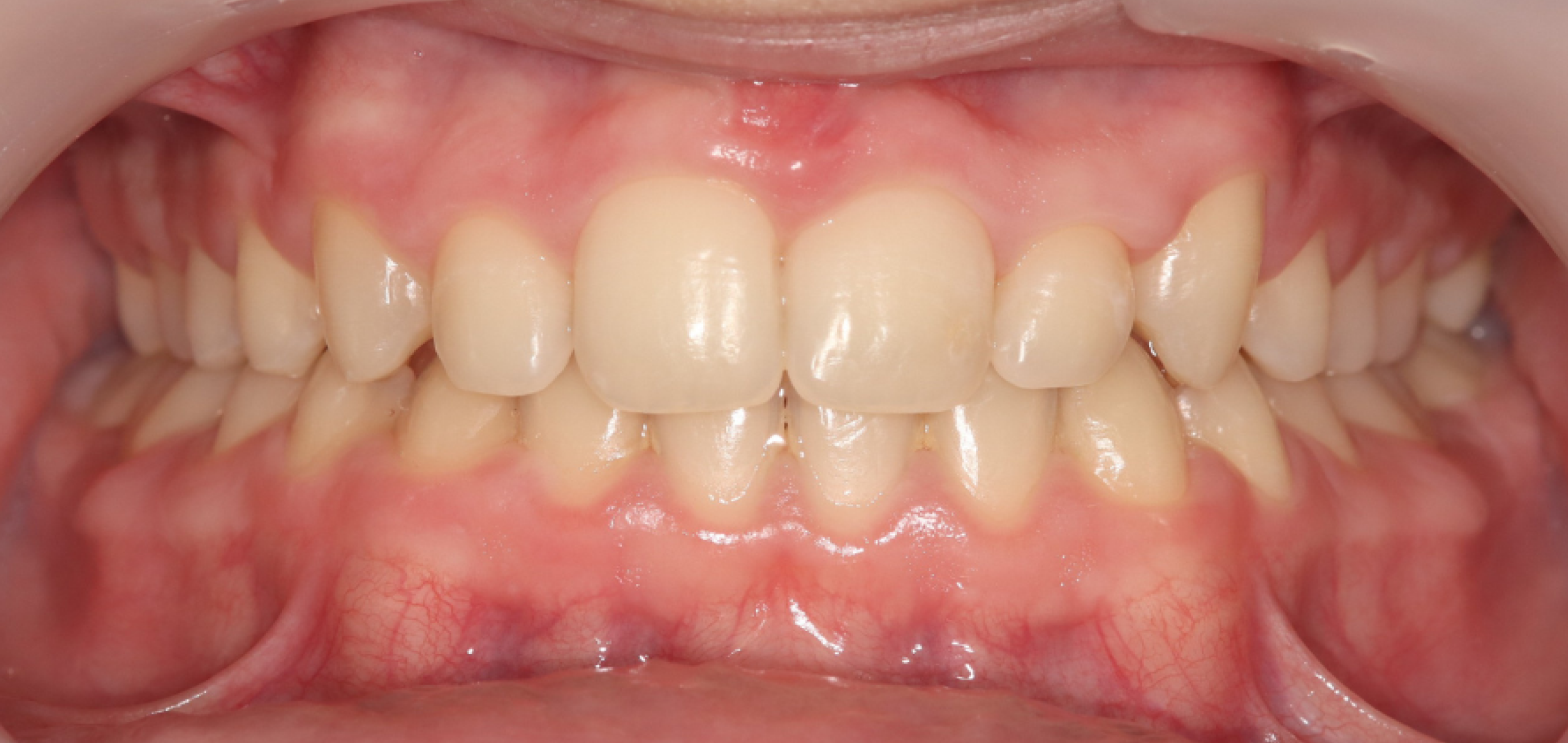 Exemples de cas traités par le Dr Quentin Boison