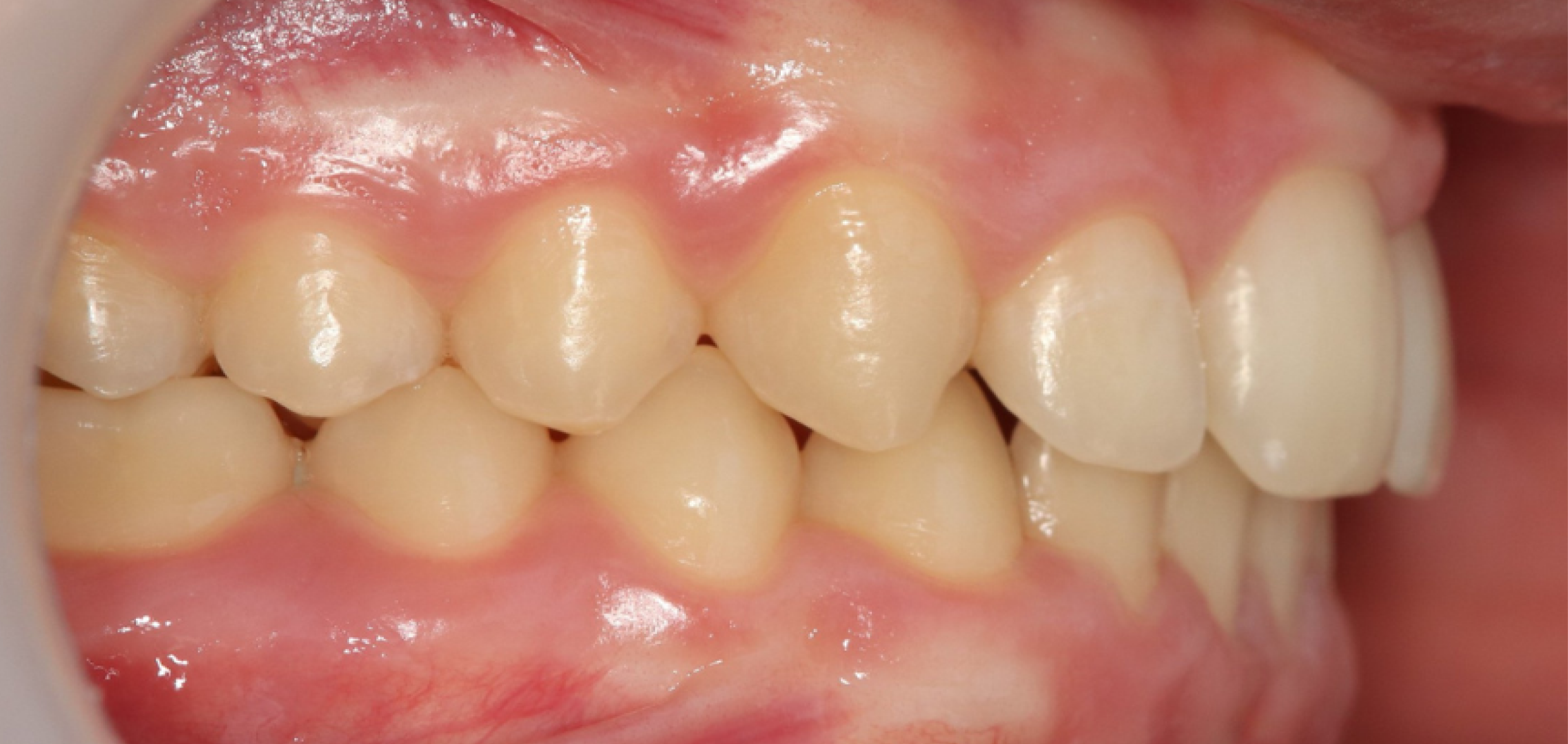 Exemples de cas traités par le Dr Quentin Boison