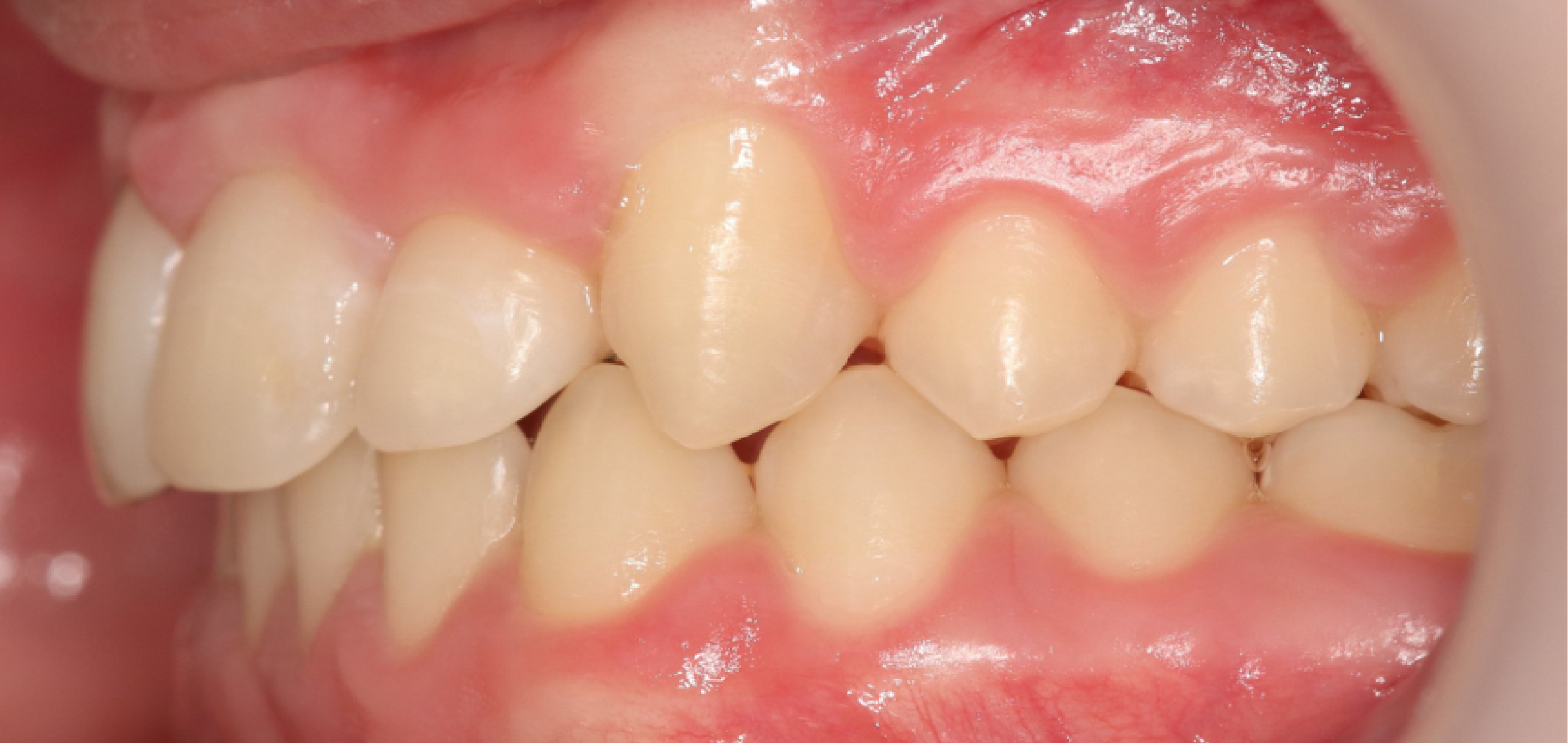 Exemples de cas traités par le Dr Quentin Boison