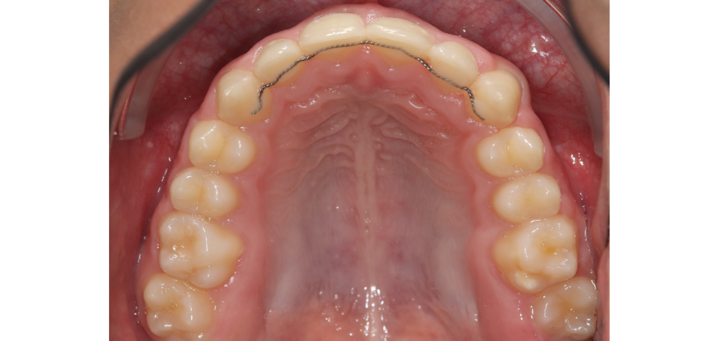 Exemples de cas traités par le Dr Quentin Boison