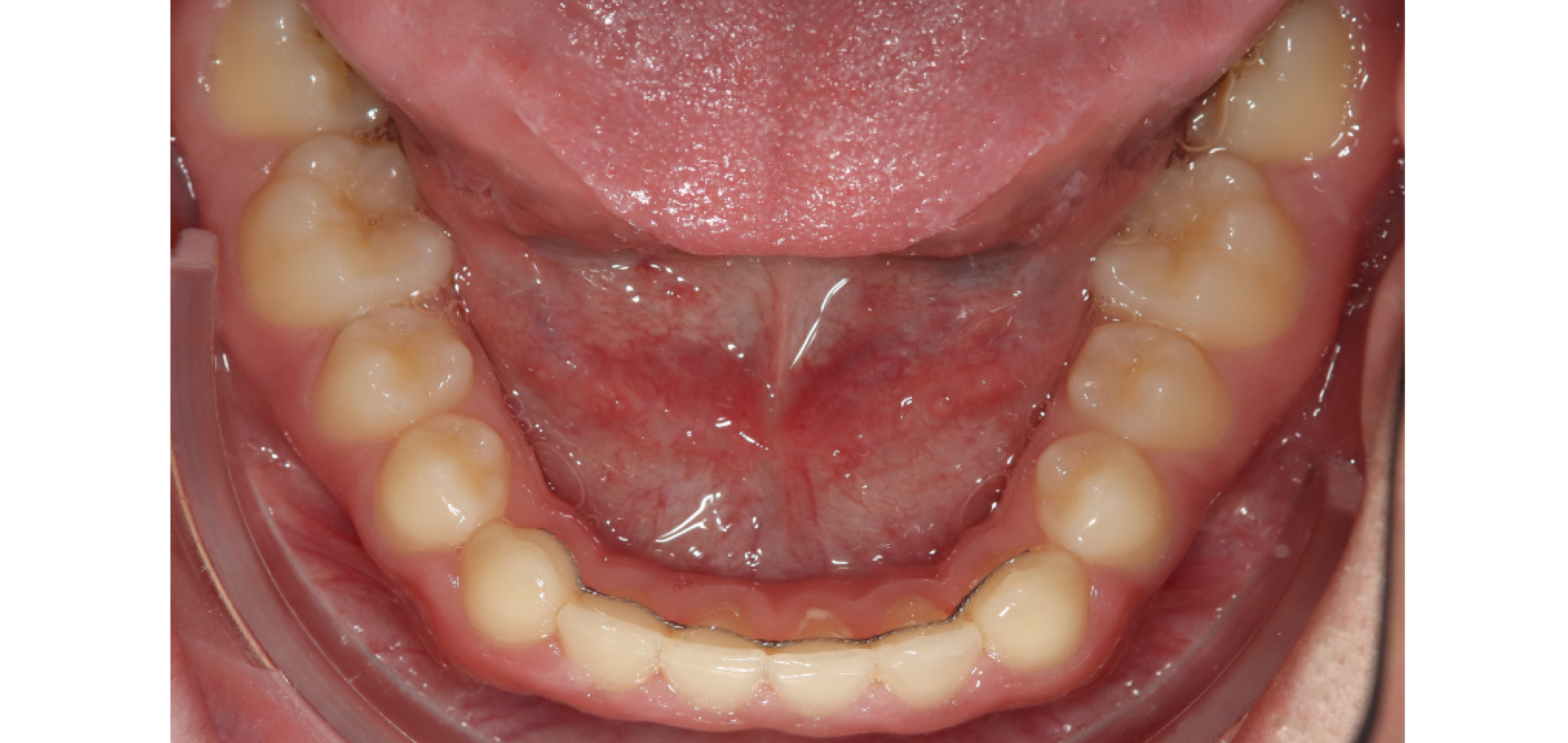Exemples de cas traités par le Dr Quentin Boison